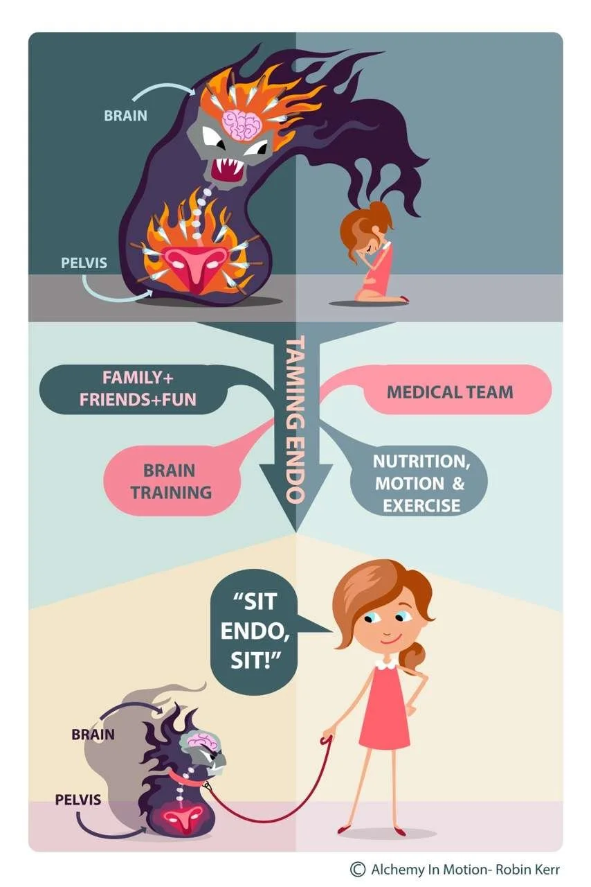 A diagram showing the connection between the brain and pelvis, with a monster representing the brain and pelvis, and a girl with a dog. The diagram illustrates the process of training to manage the monster with elements like family and friends, brain training, medical team, nutrition, motion, and exercise, culminating in a girl telling her dog to sit, end the session, and sit.