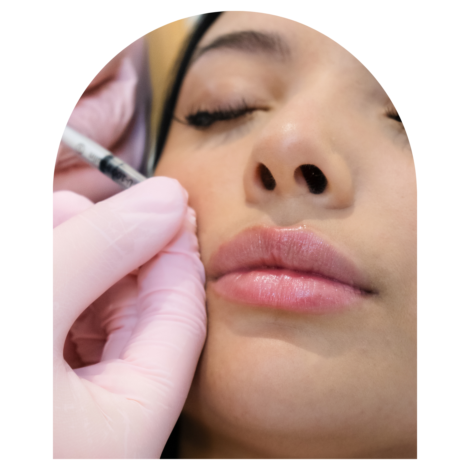 A person receiving a cosmetic injection near the lips from a medical professional wearing pink gloves.