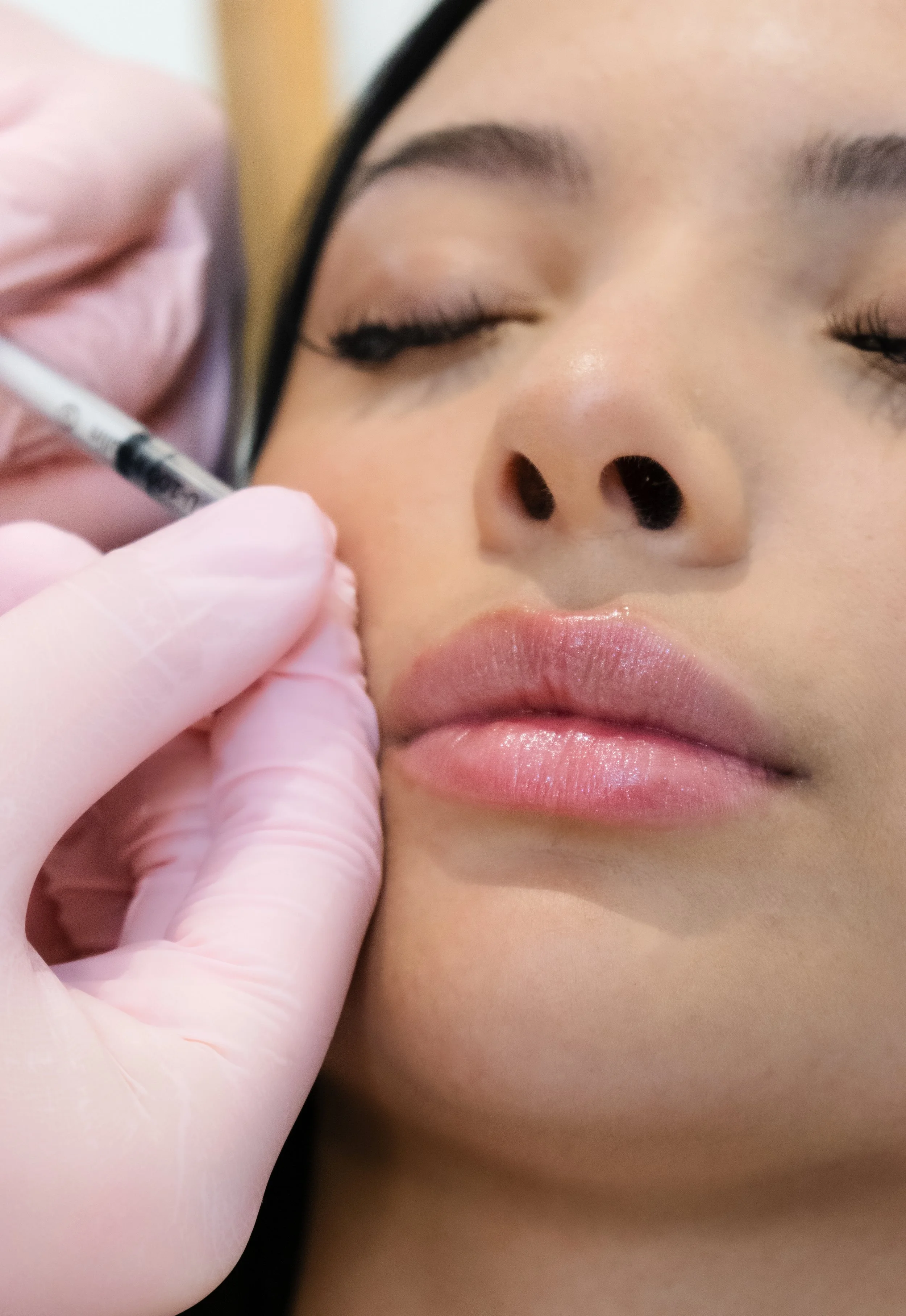Close-up of a woman receiving a cosmetic injection near her lips from a healthcare professional wearing pink gloves.