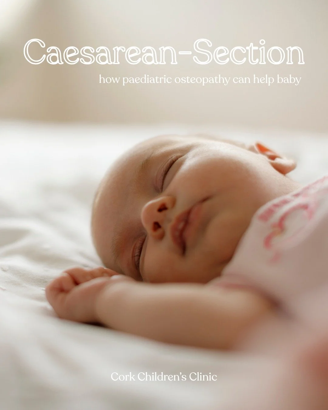 Ireland has quite a high rate of C-section deliveries. Currently, 36.6% of all mothers will have a c-section. That&rsquo;s 1 in 3 deliveries.

The main issue for a planned C-section baby is being delivered without being cleared of amniotic fluid. Bab