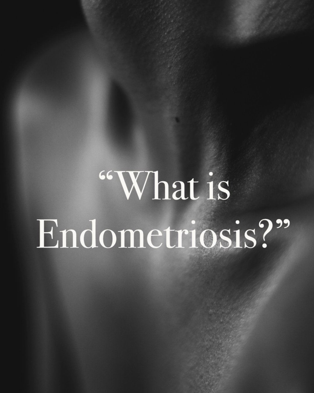       
  
    Endometriosis is a chronic inflammatory condition where tissue similar to the uterine lining grows outside the uterus often involving the ovaries, bowel, bladder, and pelvic lining.  How common is it?  Endometriosis affects ~ 1 in 10 wo