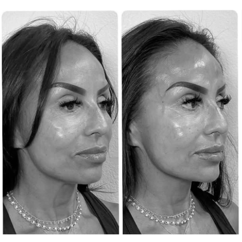 Ruhe+Aesthetics+-+Before+and+After.png