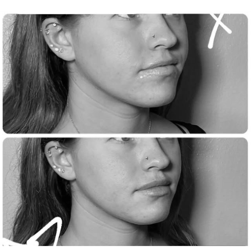 Ruhe+Aesthetics+-+Before+and+After+%282%29.png