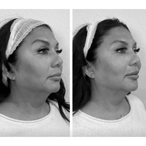 Ruhe+Aesthetics+-+Before+and+After+%285%29.png