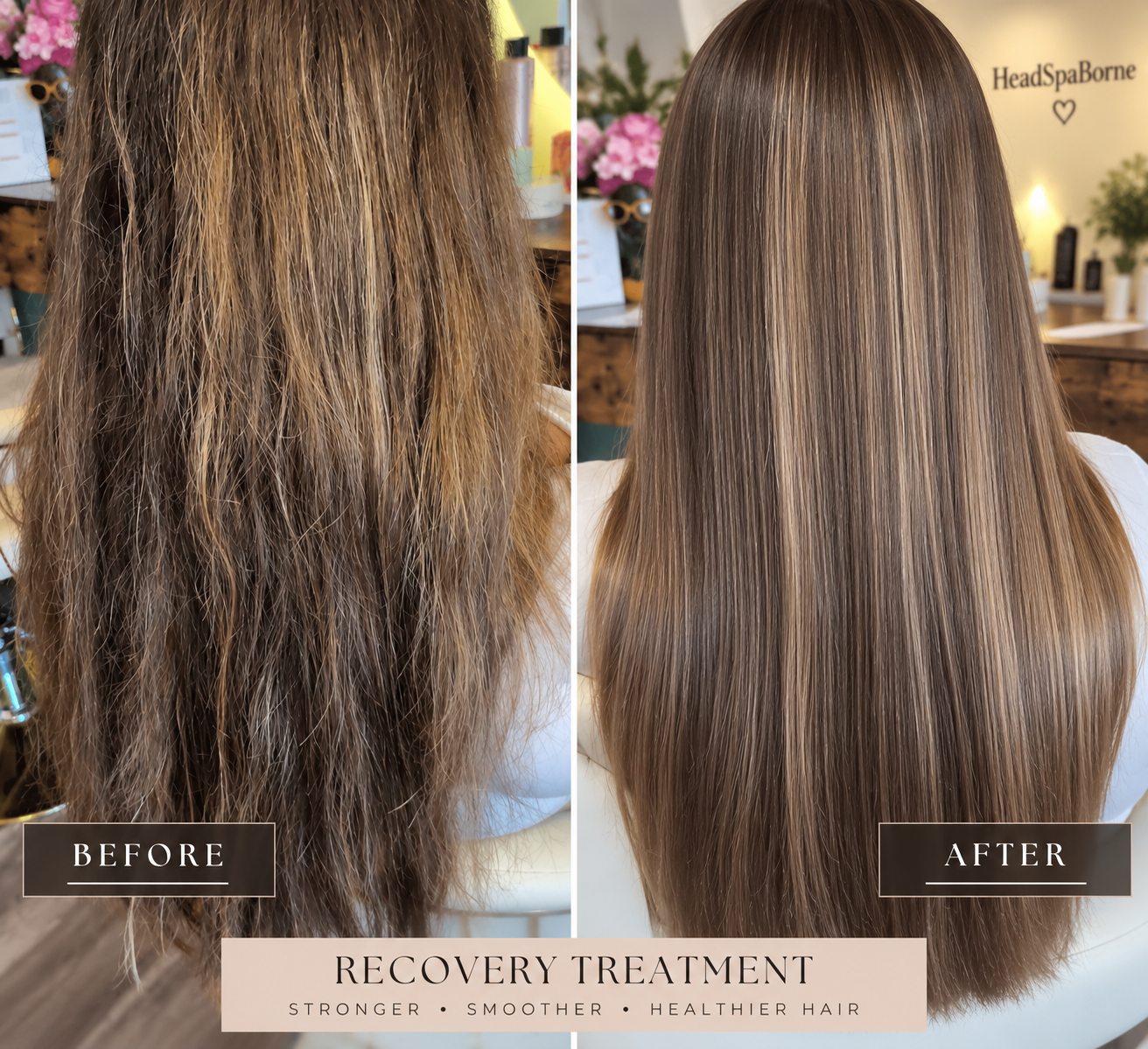 Hair Recovery Treatment
