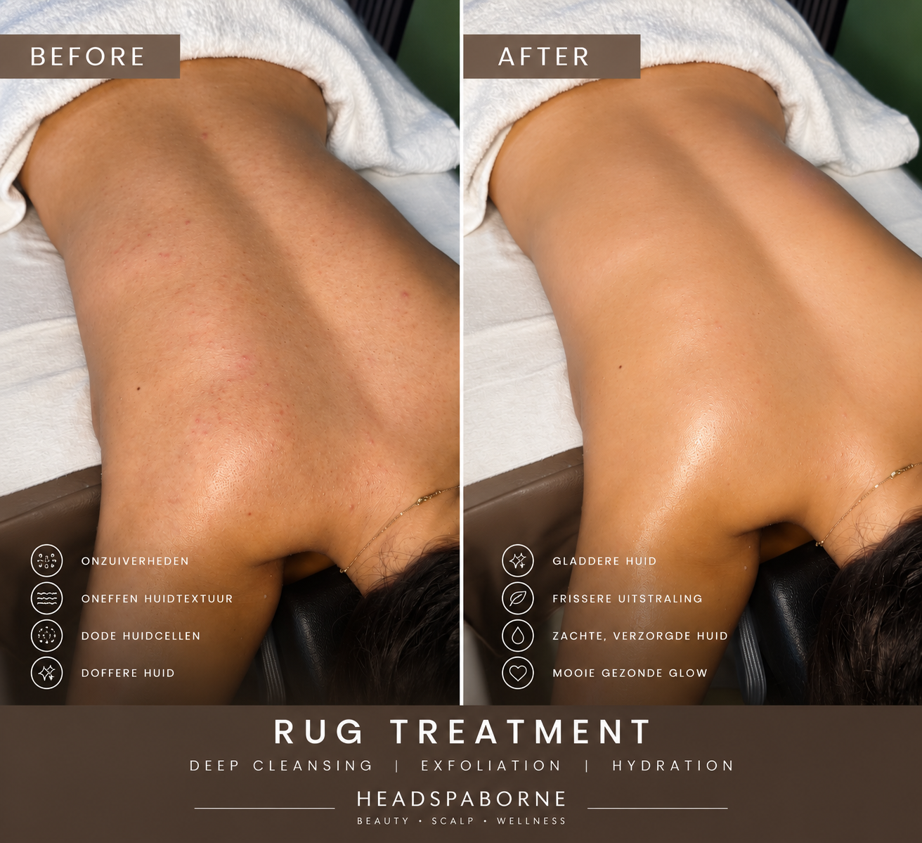 Back Scrub & Massage Treatment