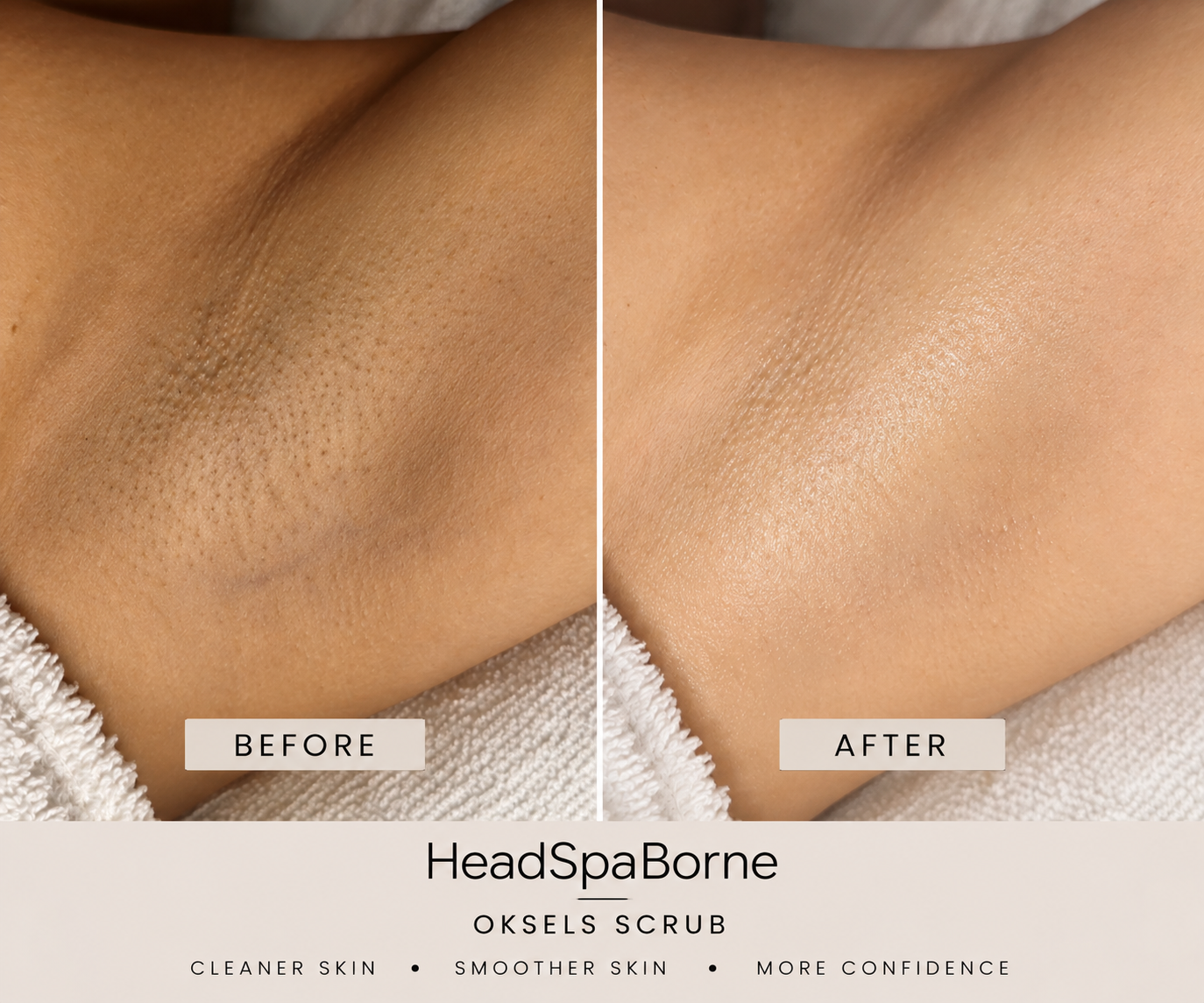 Underarm Care Treatment
