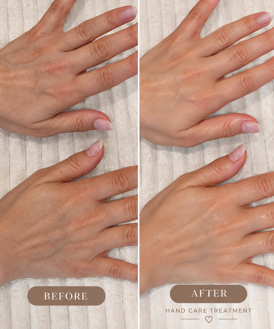 Hand Care Treatment