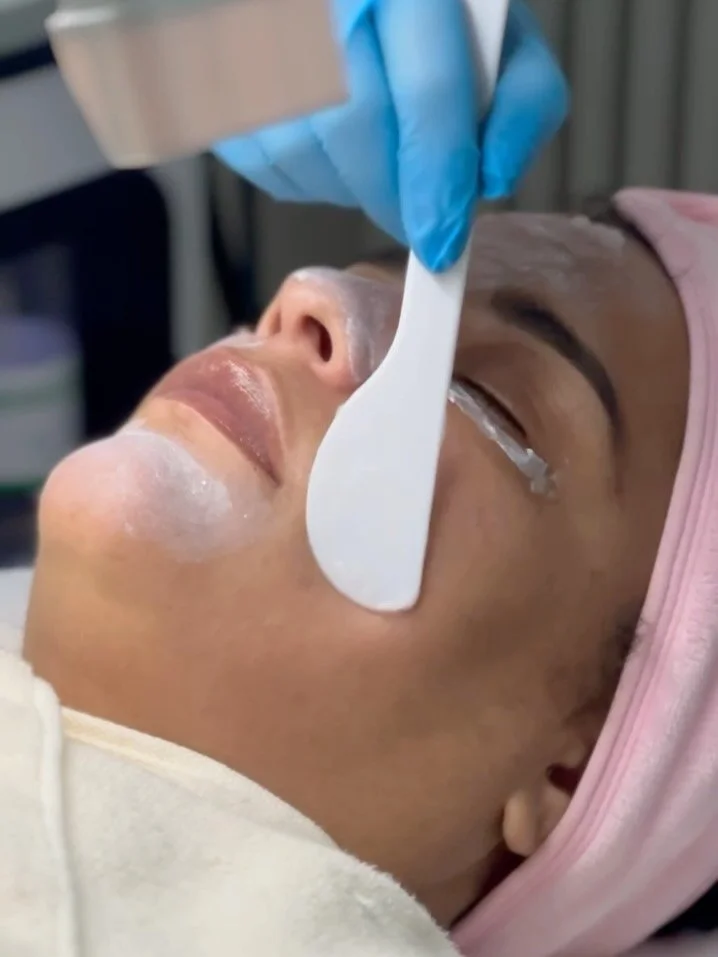 OxyGlow Schritt f&uuml;r Schritt 🫧👩🏽&zwj;⚕️

1. Wirkstoff Gel auftragen 🧴
2. Mit Carbonathartkapsel &uuml;ber das Gesicht fahren 
3. Hier kommt es zum &bdquo;Bohr Effekt&ldquo; 🫧
4. Algenmaske ✨ 

Und let&rsquo;s Glow! 🥰 

#passau #kosmetik #ge