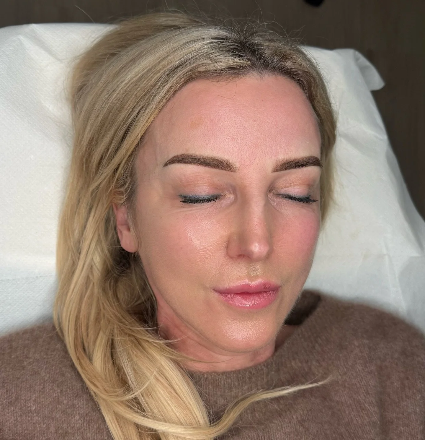 Perfect Brows 🥰✨ 

Keine Symmetrie? Kein Problem! In den meisten F&auml;llen k&ouml;nnen wir die Augenbrauen wieder symmetrisch machen. 🧚✨ 

Ergebnis heilt heller ab 🫶🏼 

Keine Lust mehr auf t&auml;gliches Augenbrauen schminken? Dann sind Powder 