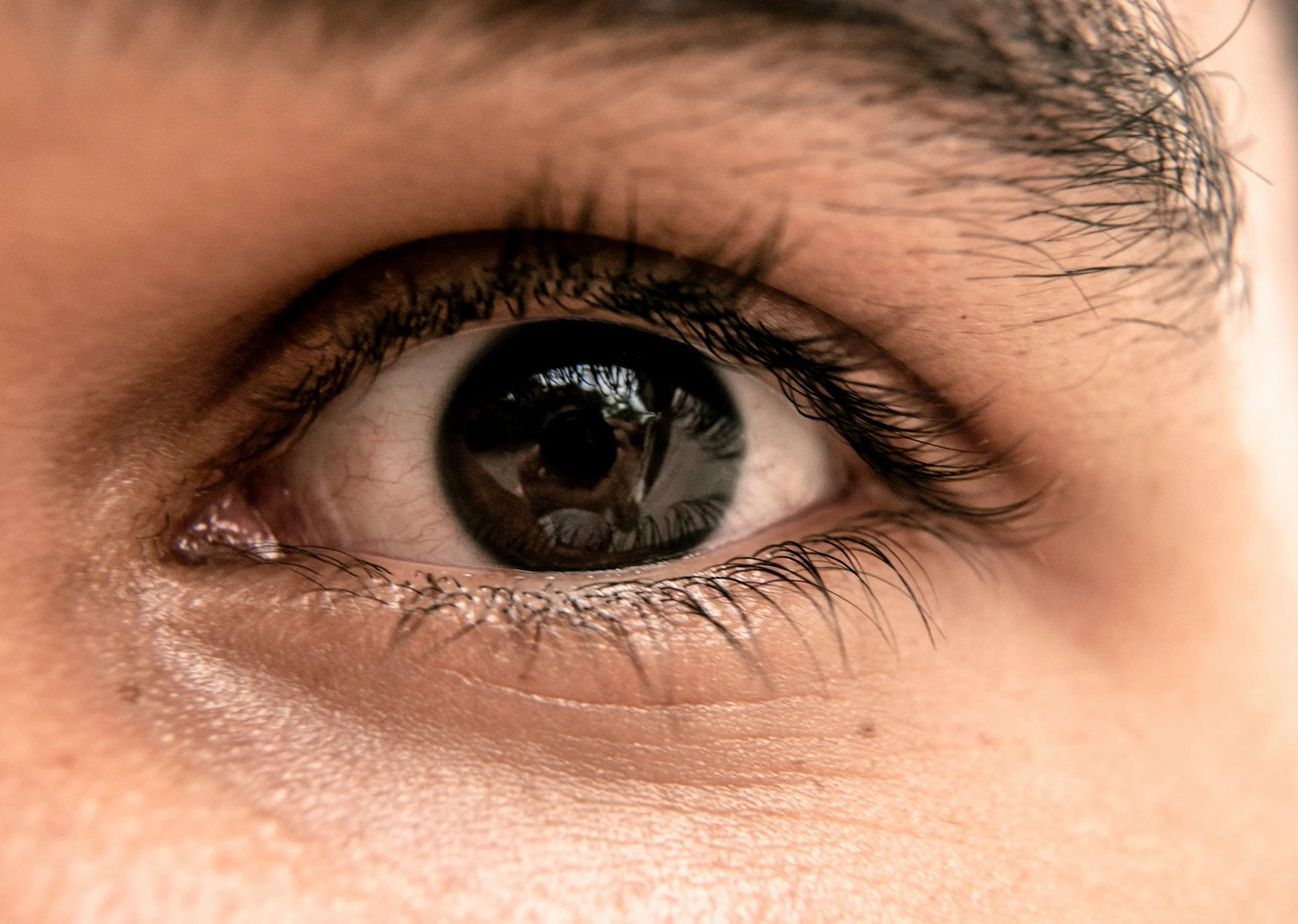 Under-Eye Treatments in Muswell Hill — Dark Circles, Hollows and Tiredness Explained