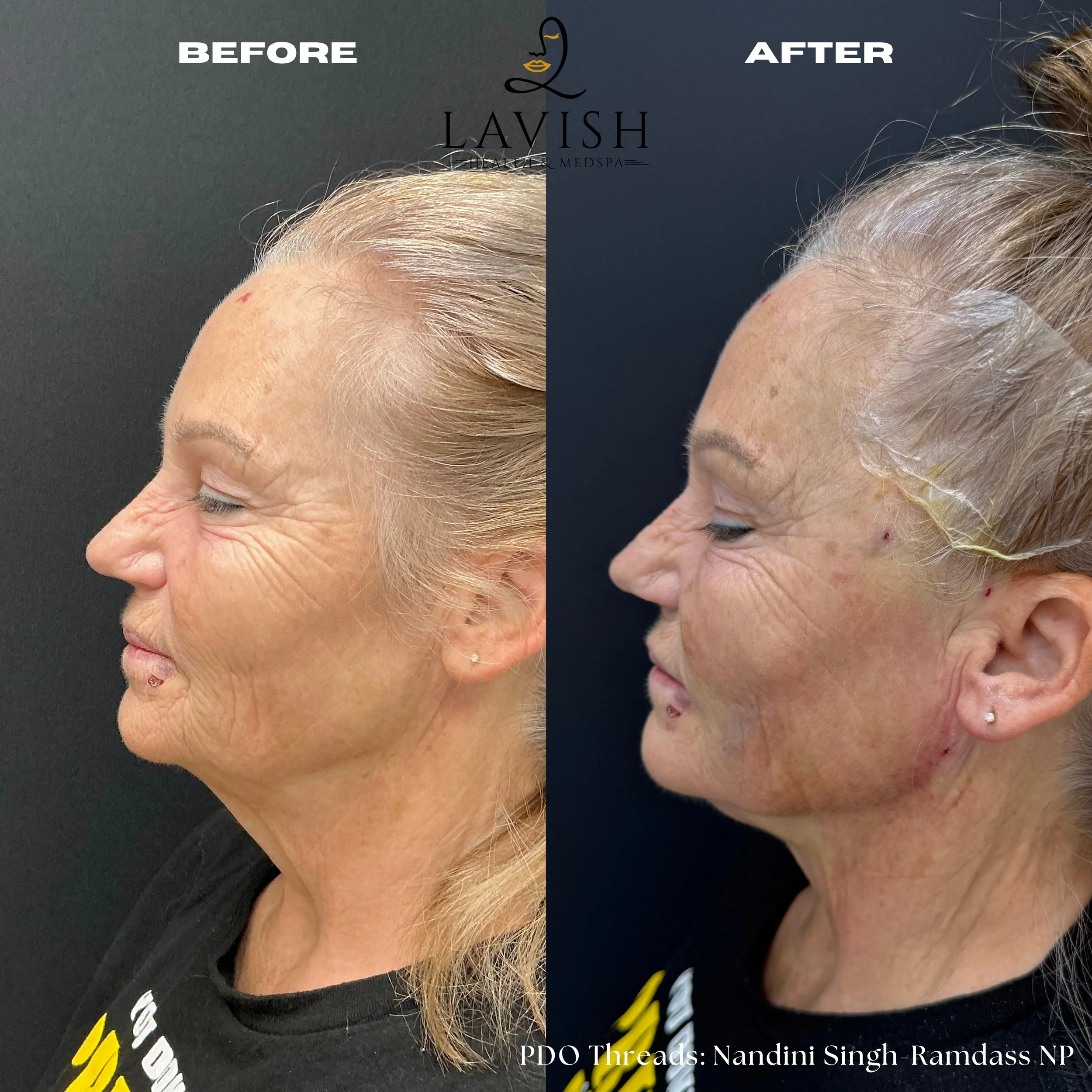 Before and Afterpdo4.jpg