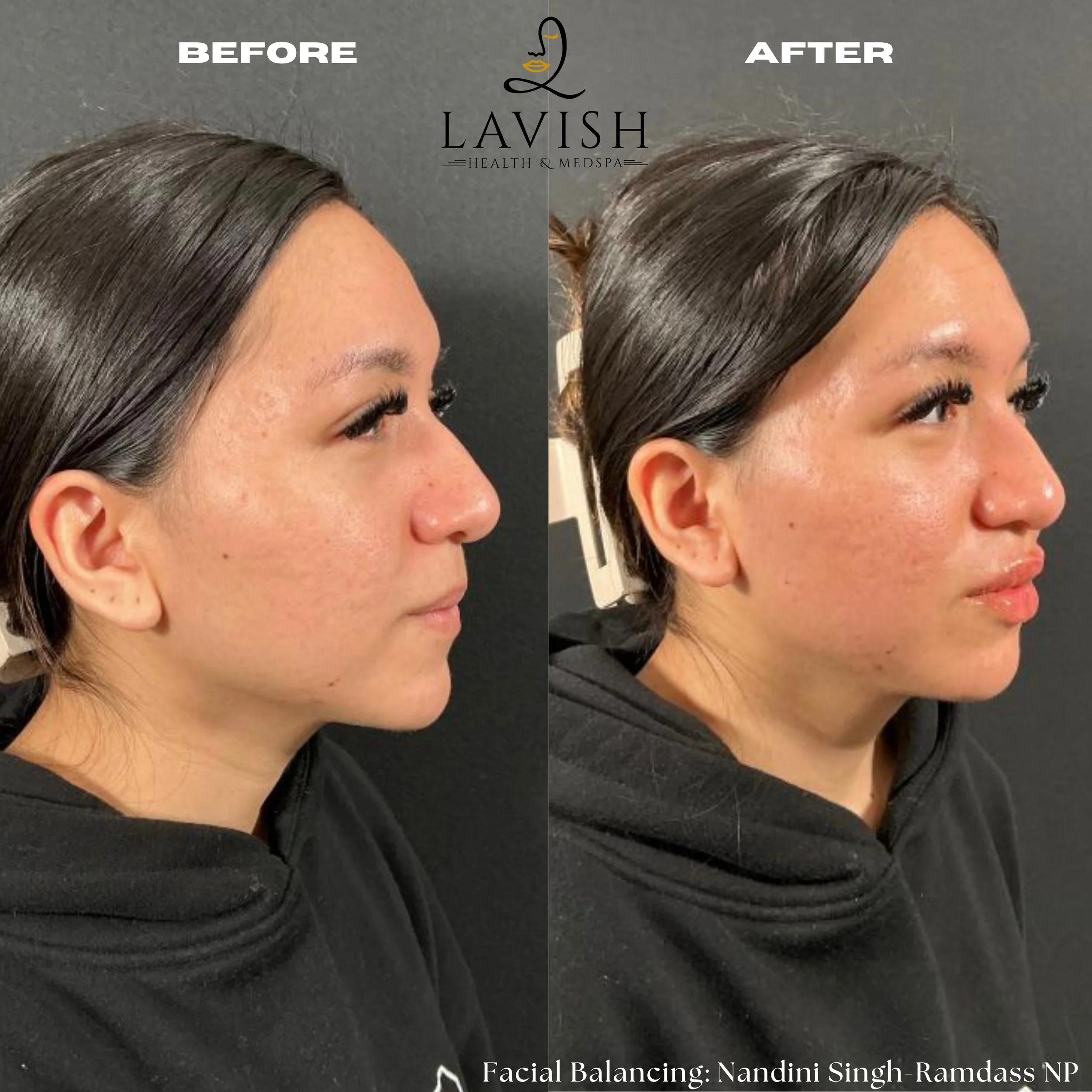 Before and After1.jpg