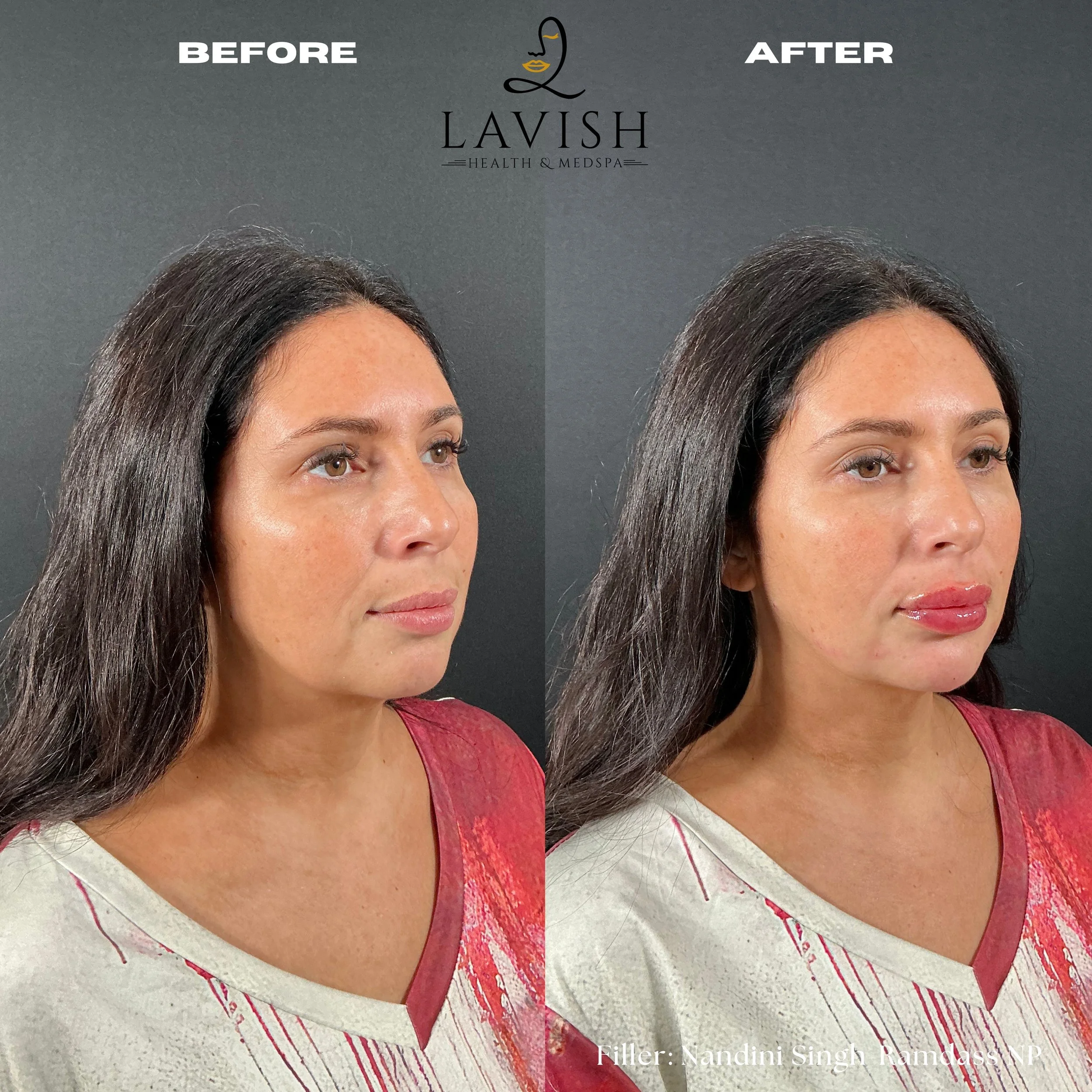 Before and After4.jpg