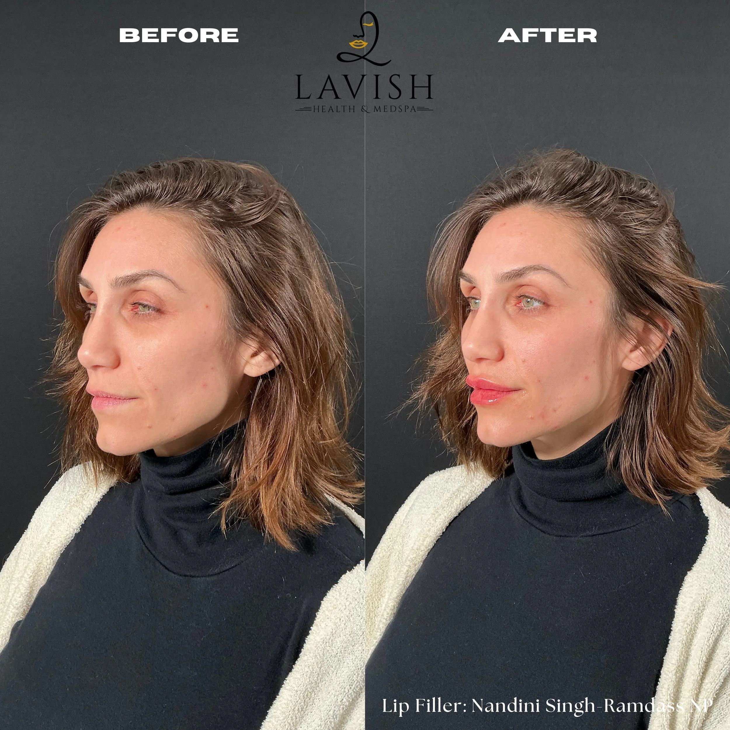 Before and After6.jpg