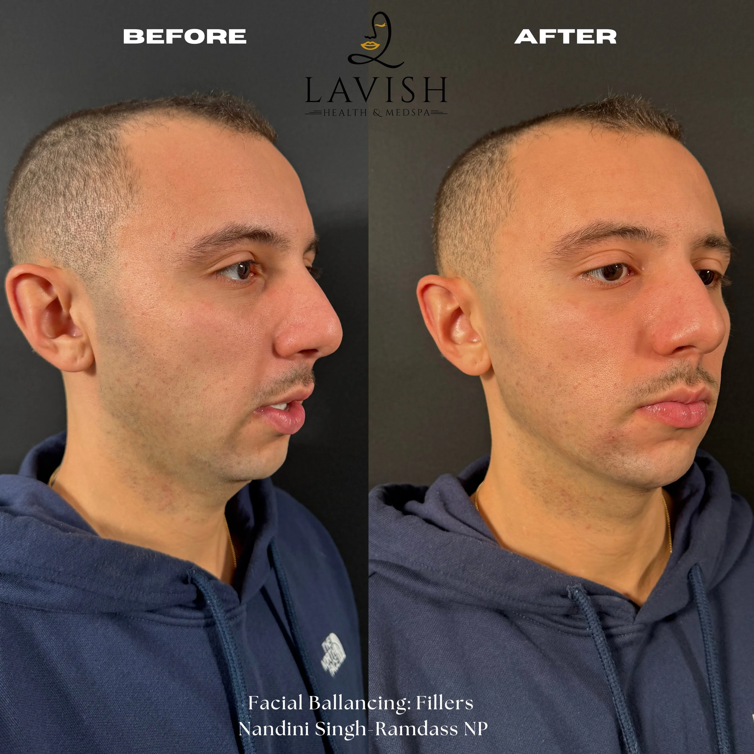 Before and After7.jpg