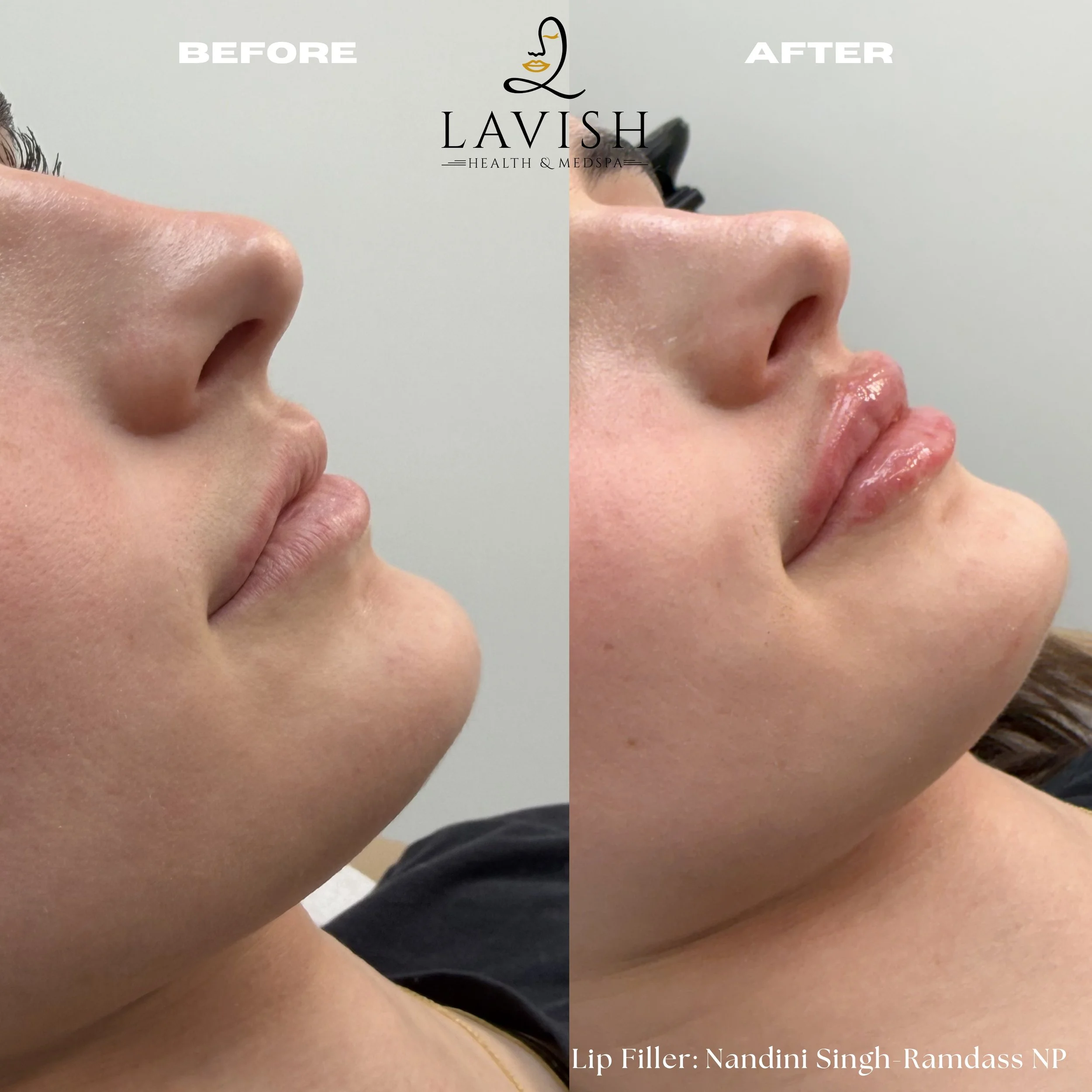 Before and After2.jpg