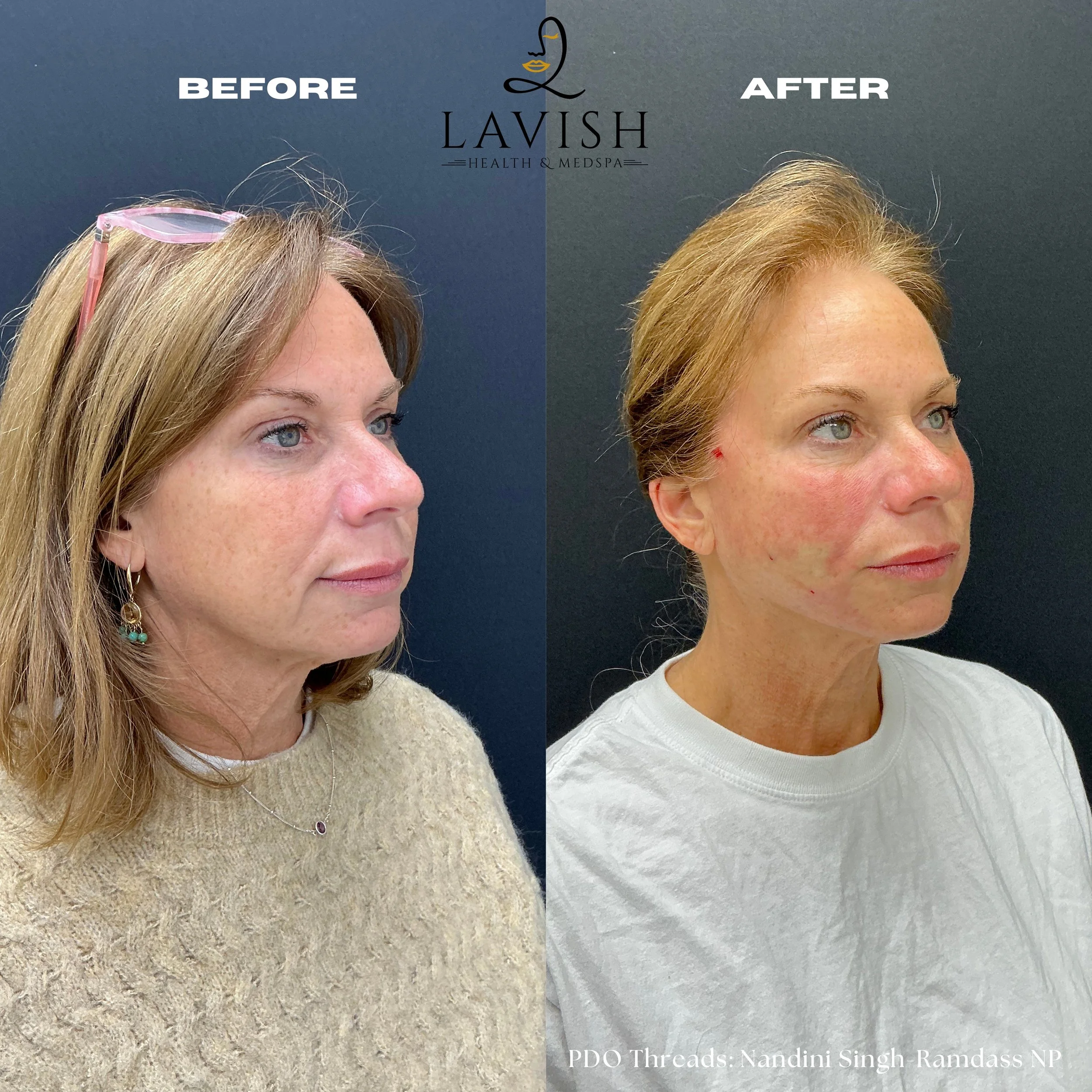 Before and Afterpdo.jpg