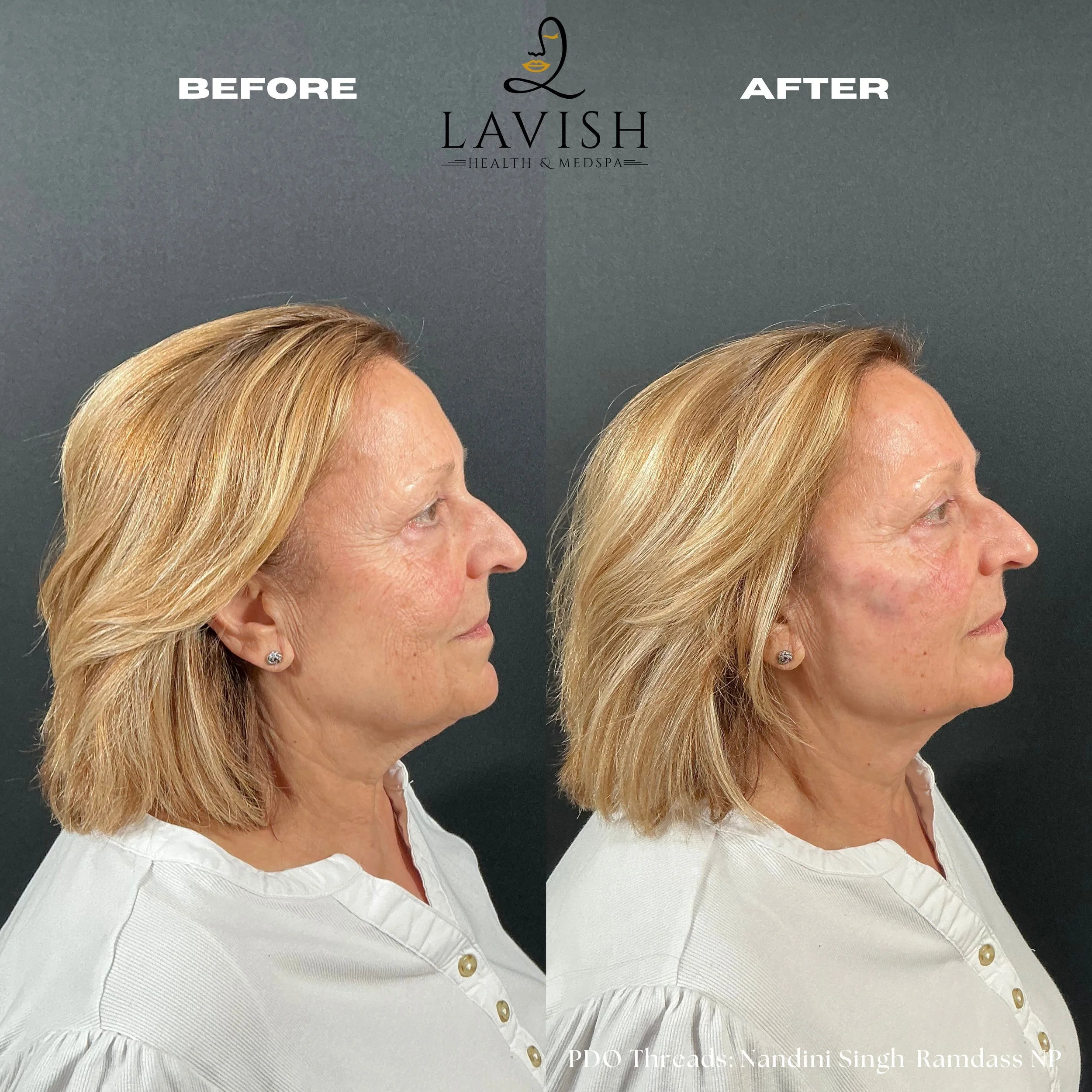 Before and Afterpdo2.jpg