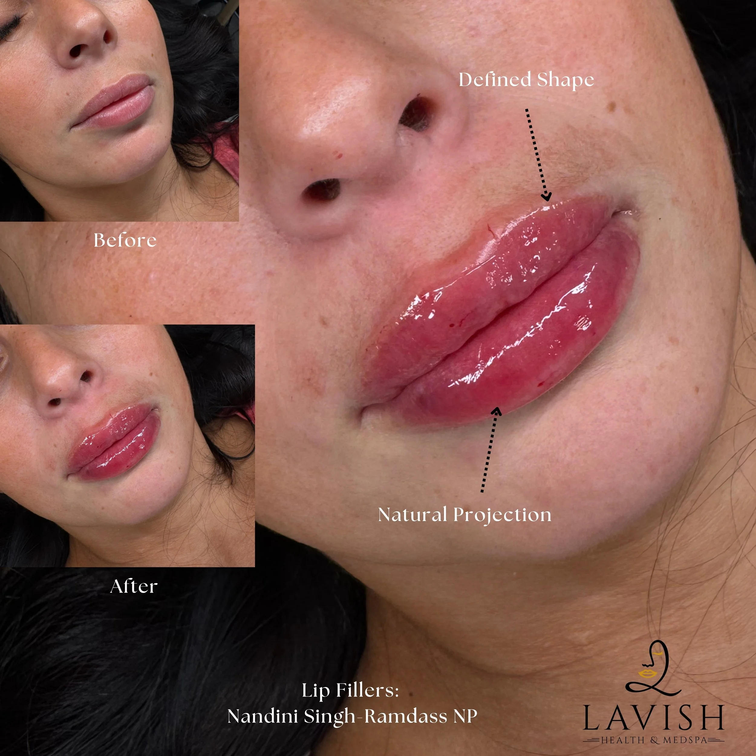 Before and After5.jpg