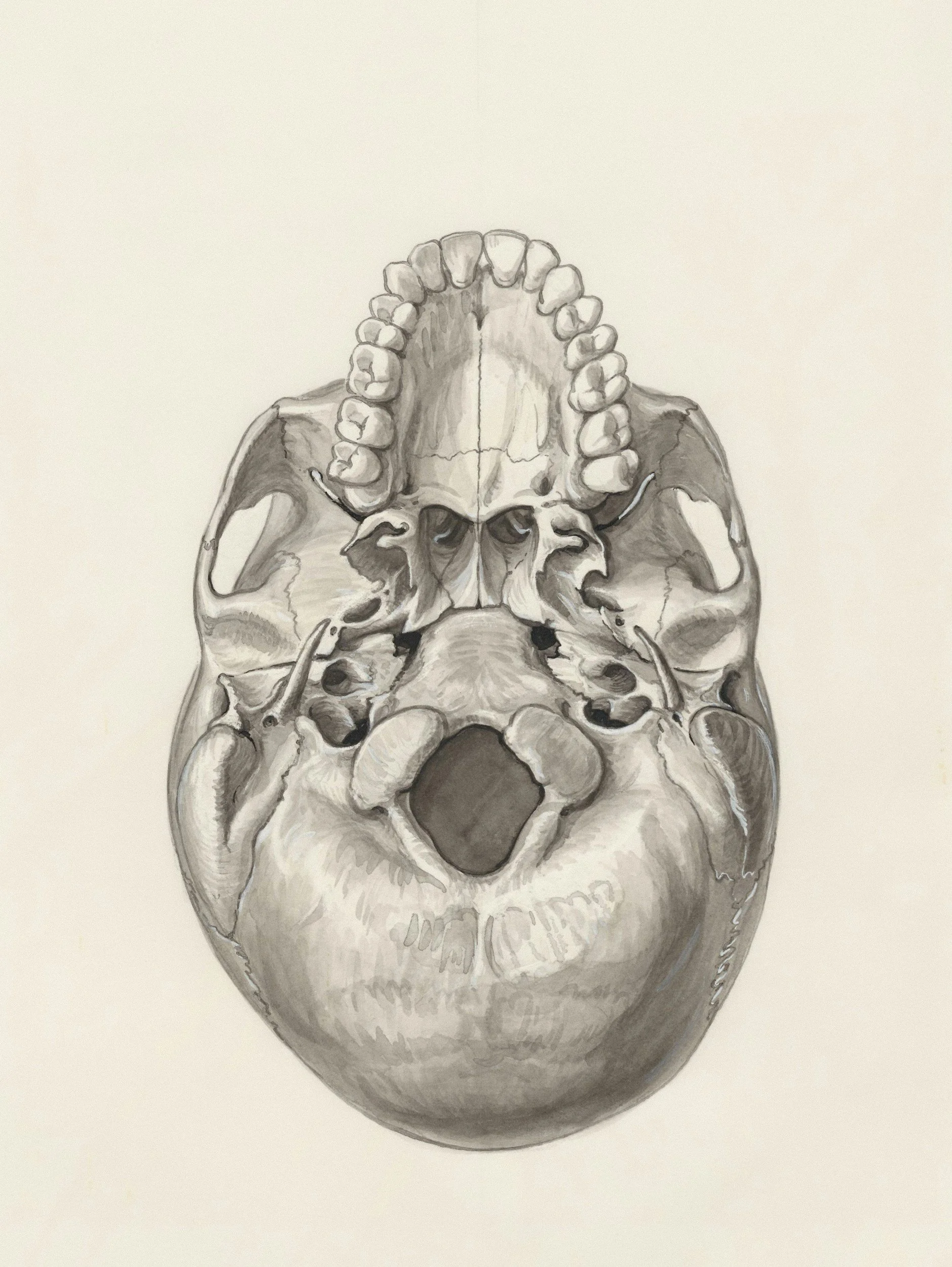 Chordomas &amp; Chondrosarcomas