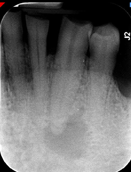 #22 Pre-op
