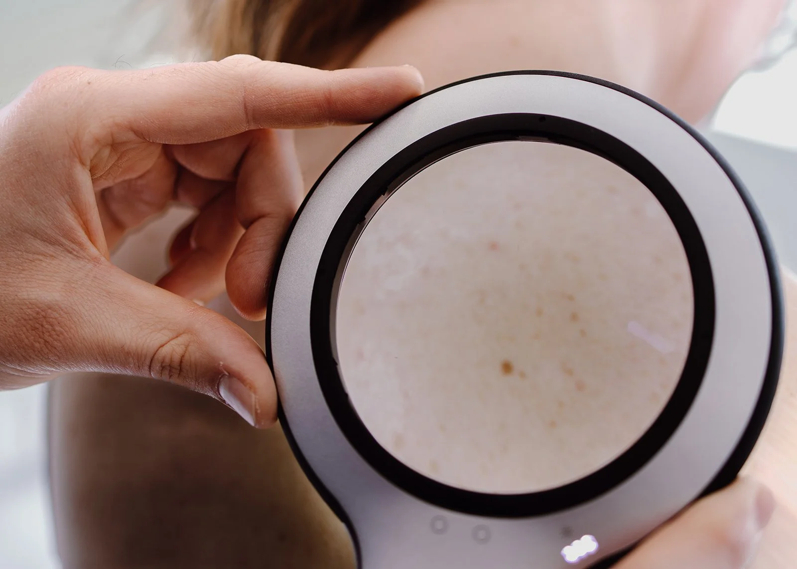 Dr Calum Stannett completing a skin check on a patient using a dermlite lumio dermatoscope