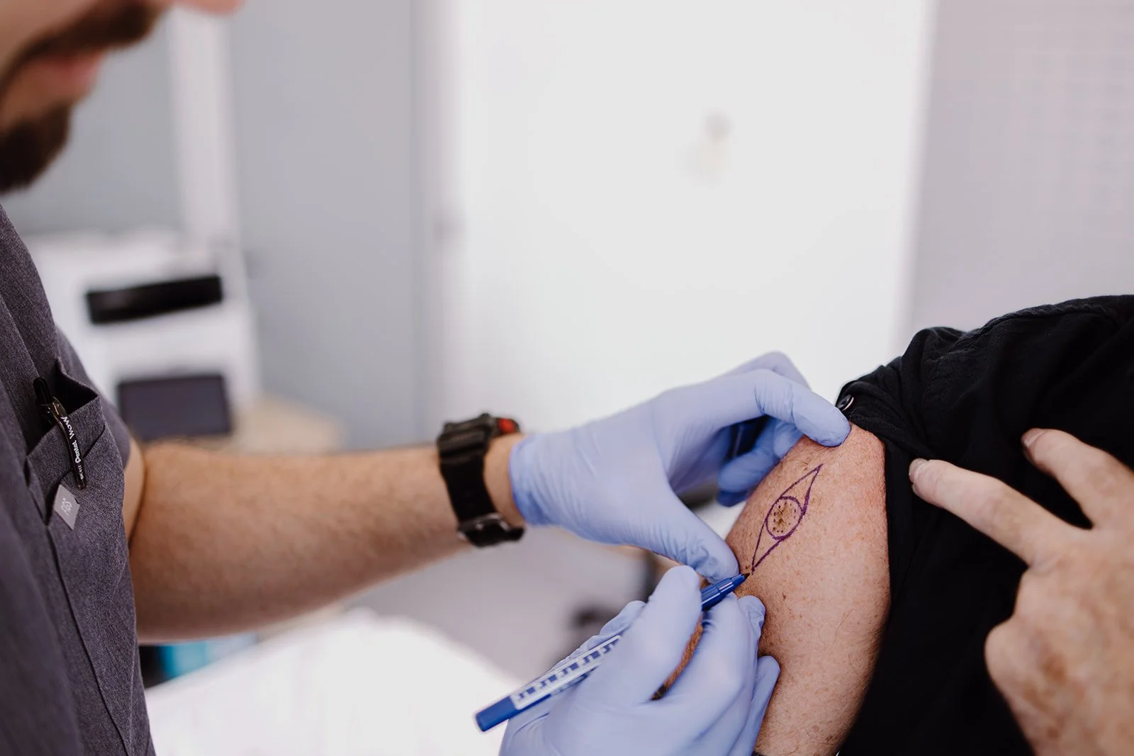 Dr Calum Stannett marking out a skin lesion for a procedure, in preparation for a minor surgery