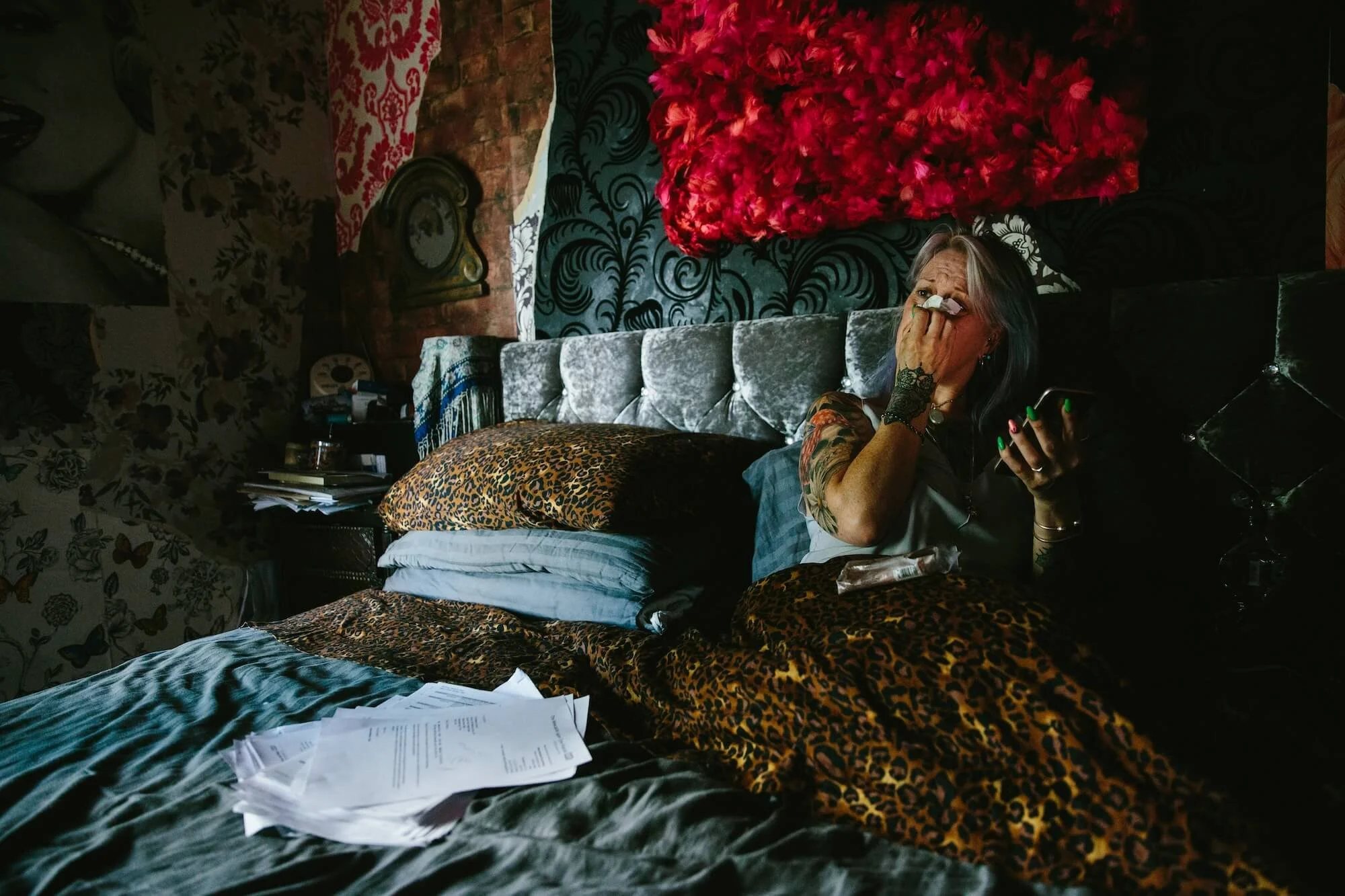 The Twins Photography Portraiture Documentary Projects BBC Mesh Implants4.jpg