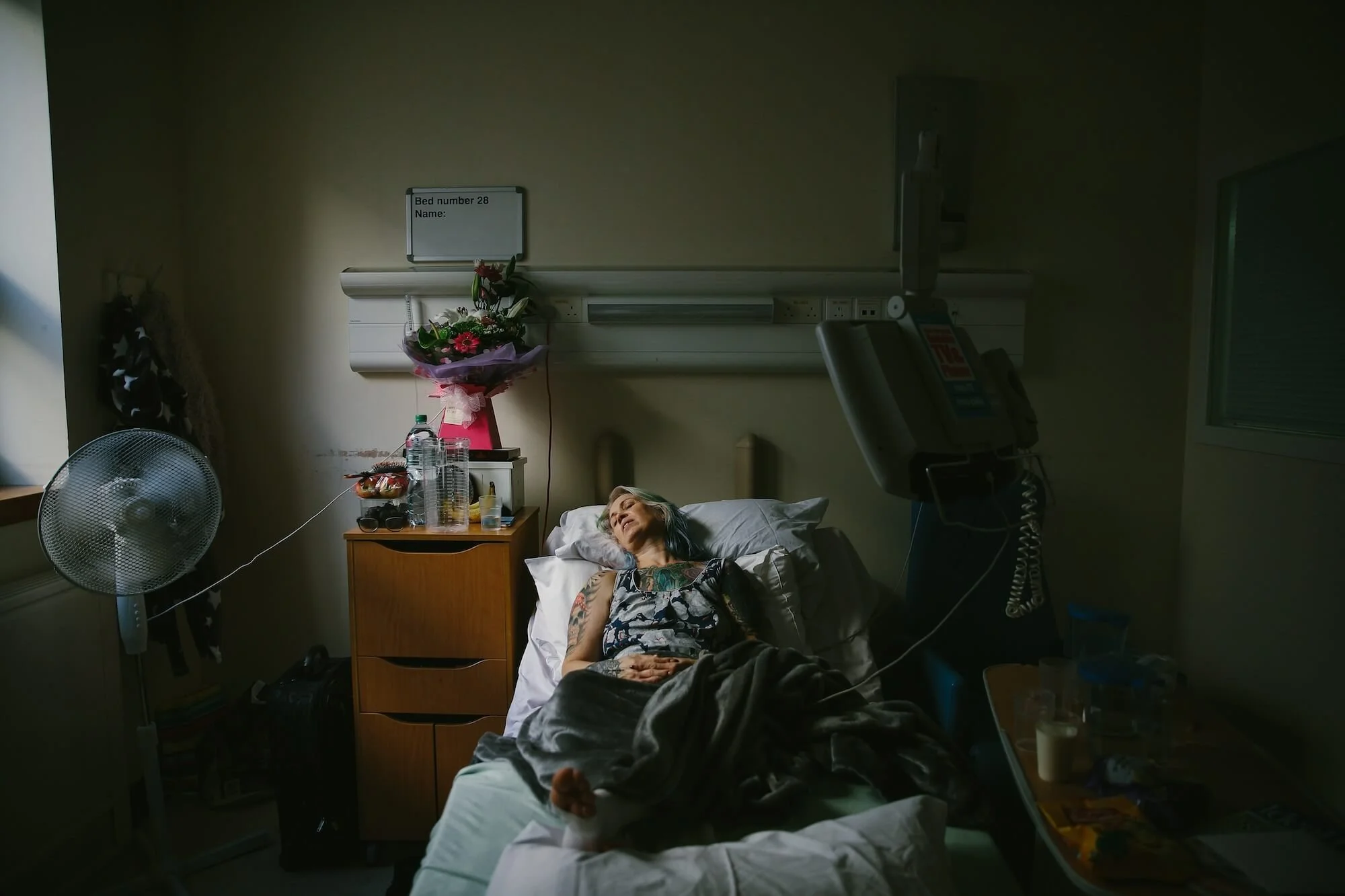 The Twins Photography Portraiture Documentary Projects BBC Mesh Implants11.jpg