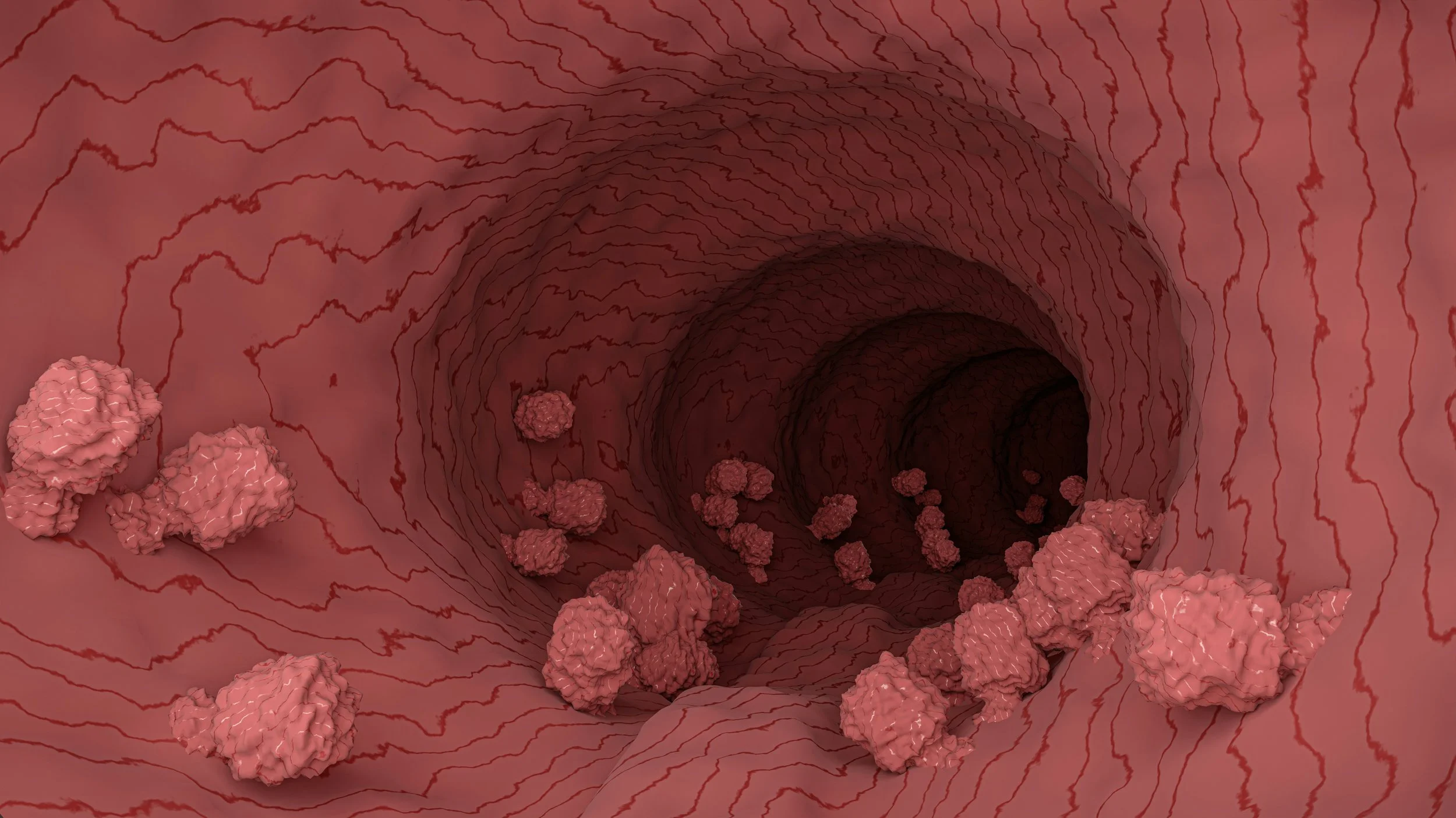 Optimising Treatment