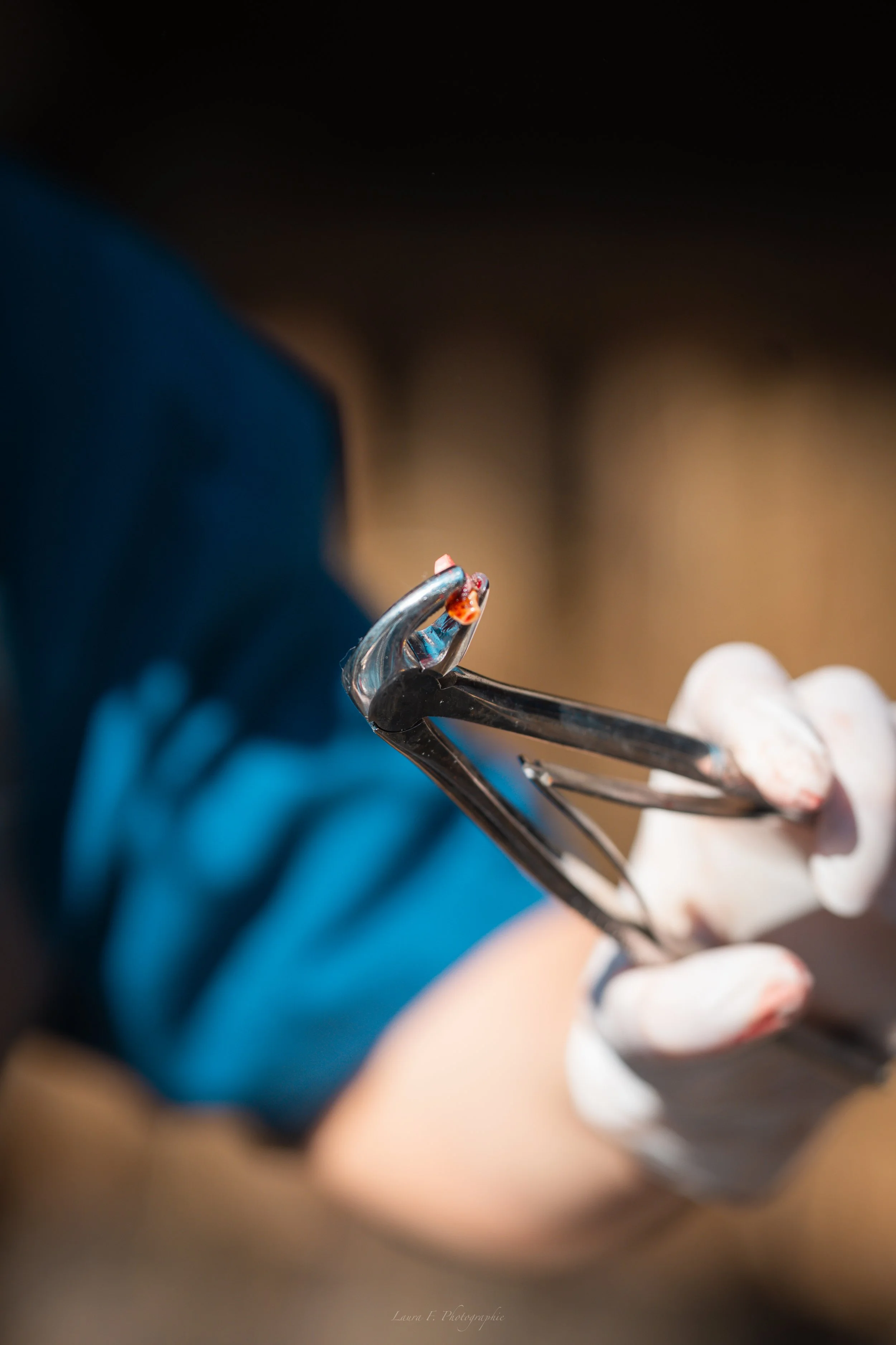 Une main en gants blancs tient une pince à épiler avec une petite tique à l'extrémité. La personne porte une chemise bleue. L'image est floue à l'arrière-plan.