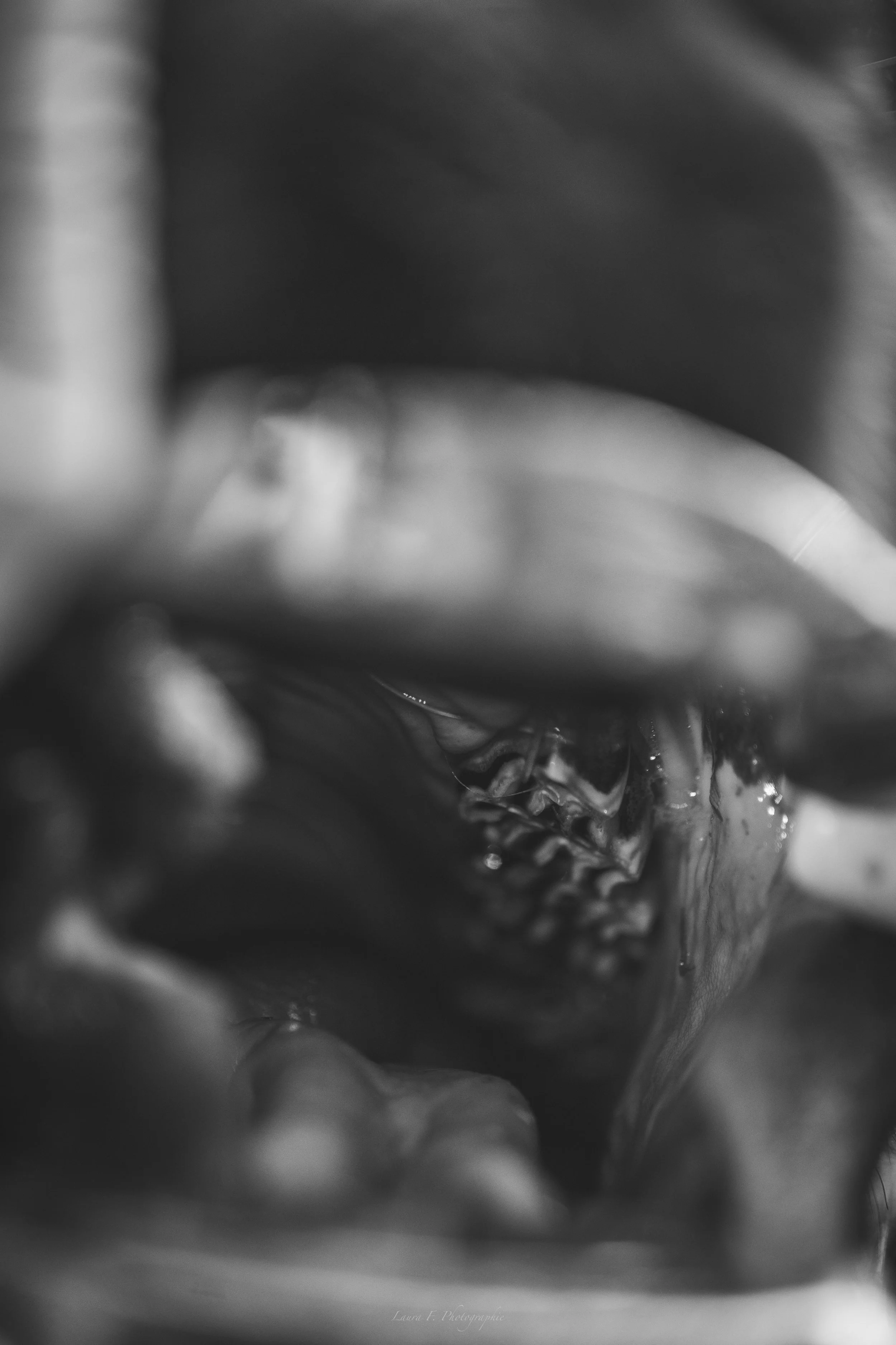 Photo en noir et blanc d'une bouche ouverte montrant des dents et la langue, vue de face.