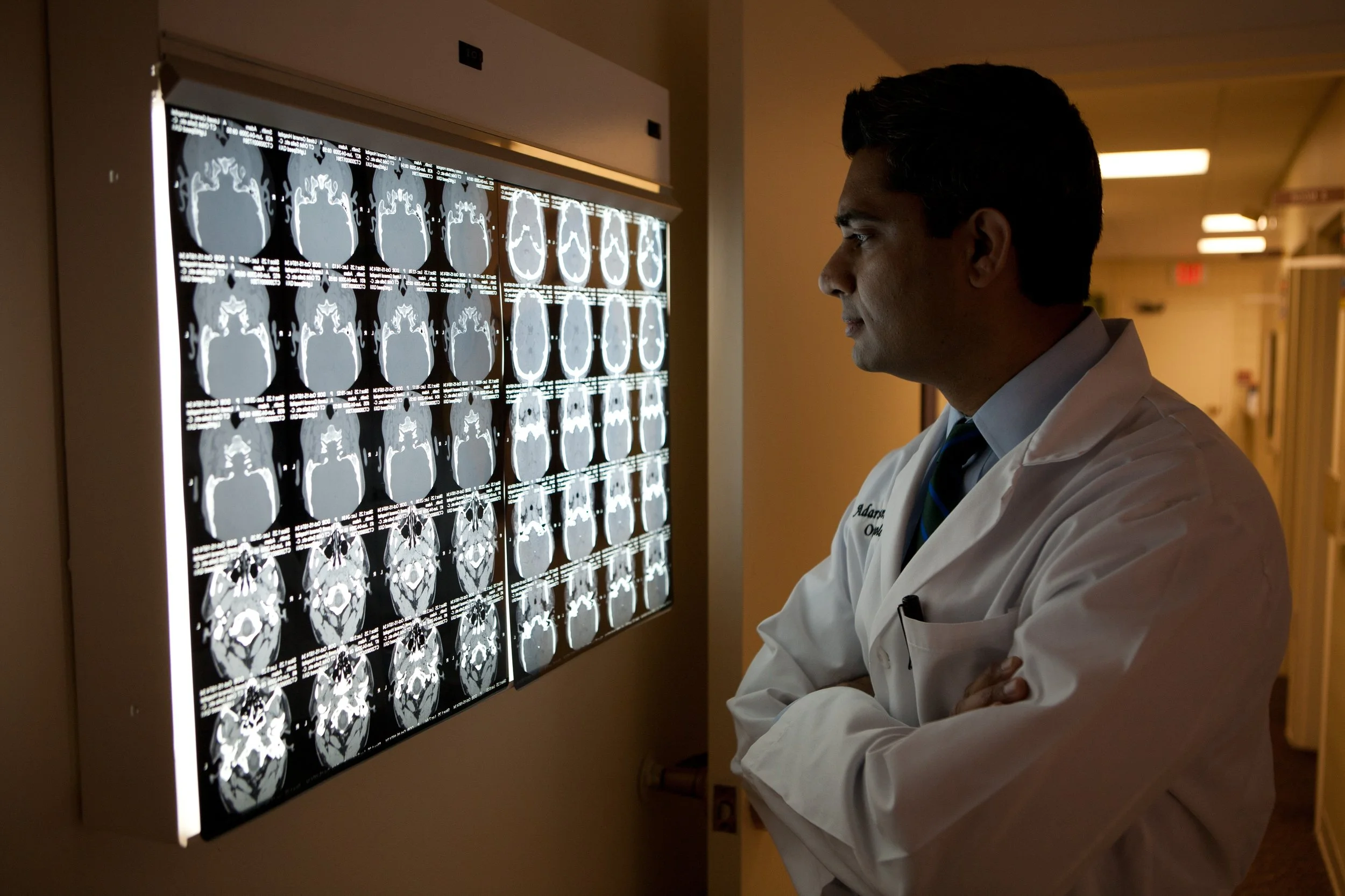 A male doctor in a white coat examining brain scan images on a backlit lightbox in a hospital corridor.