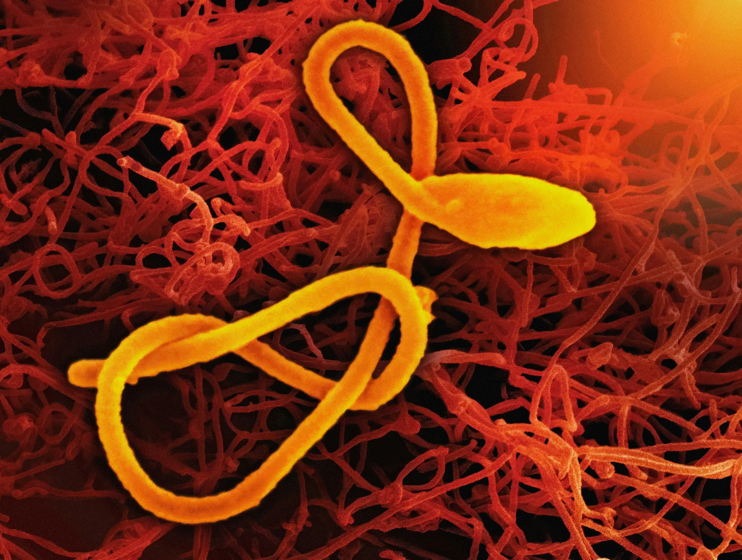 Parasites and Chronic Illness: An Overlooked Piece of the Puzzle