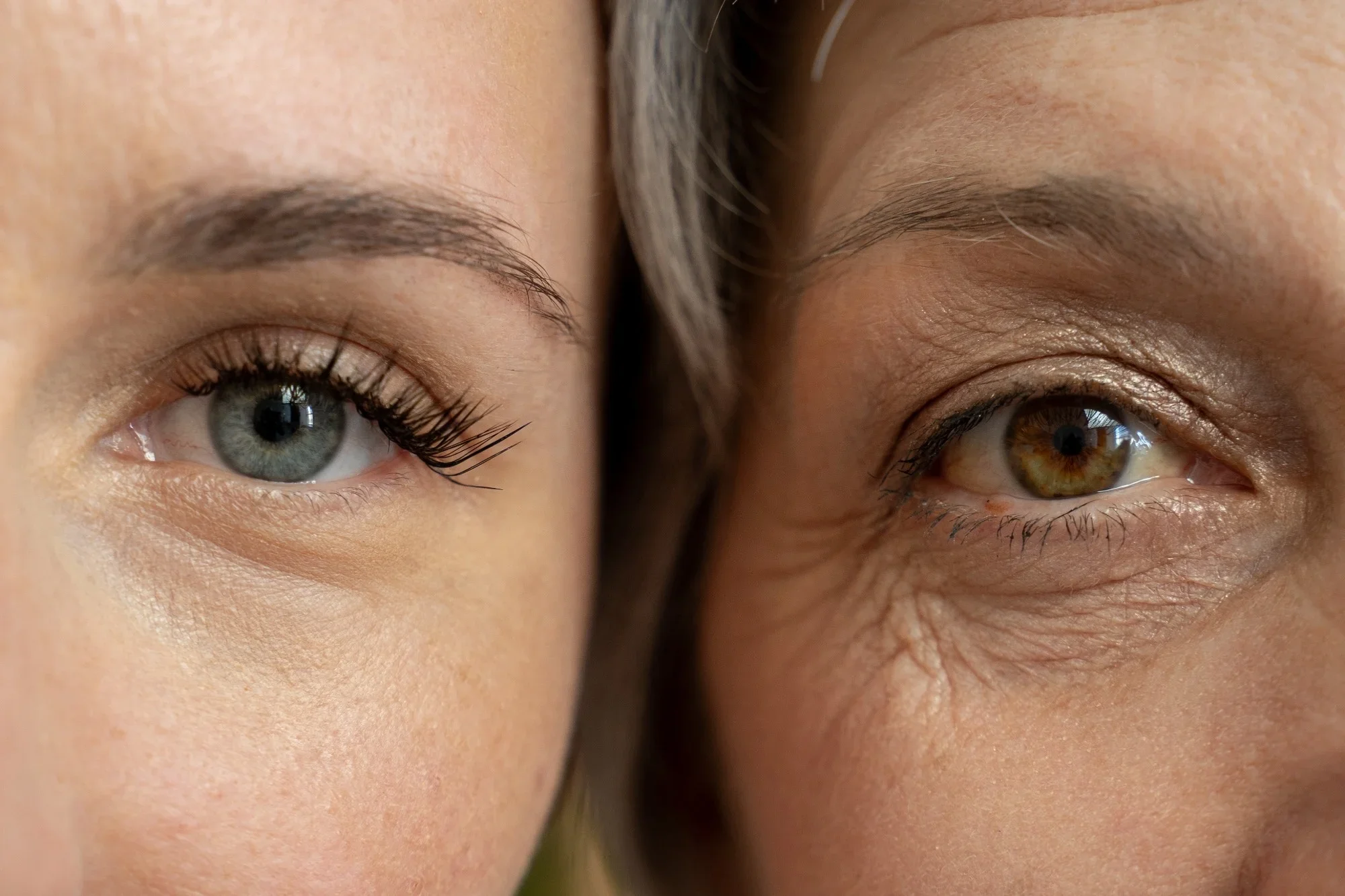 BEYOND the surface- deeper reality of skin aging