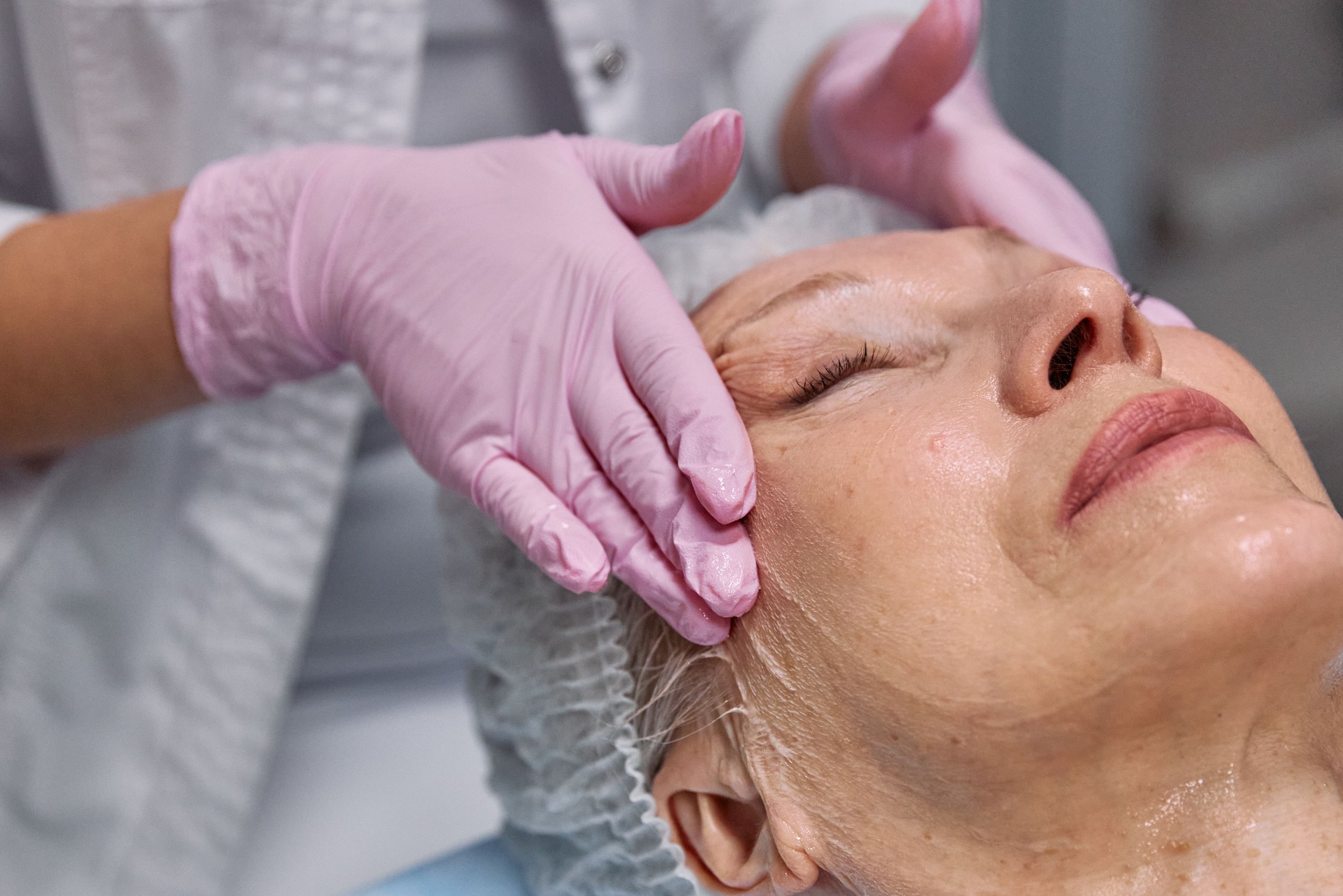 Dermaplaning Myths and Facts