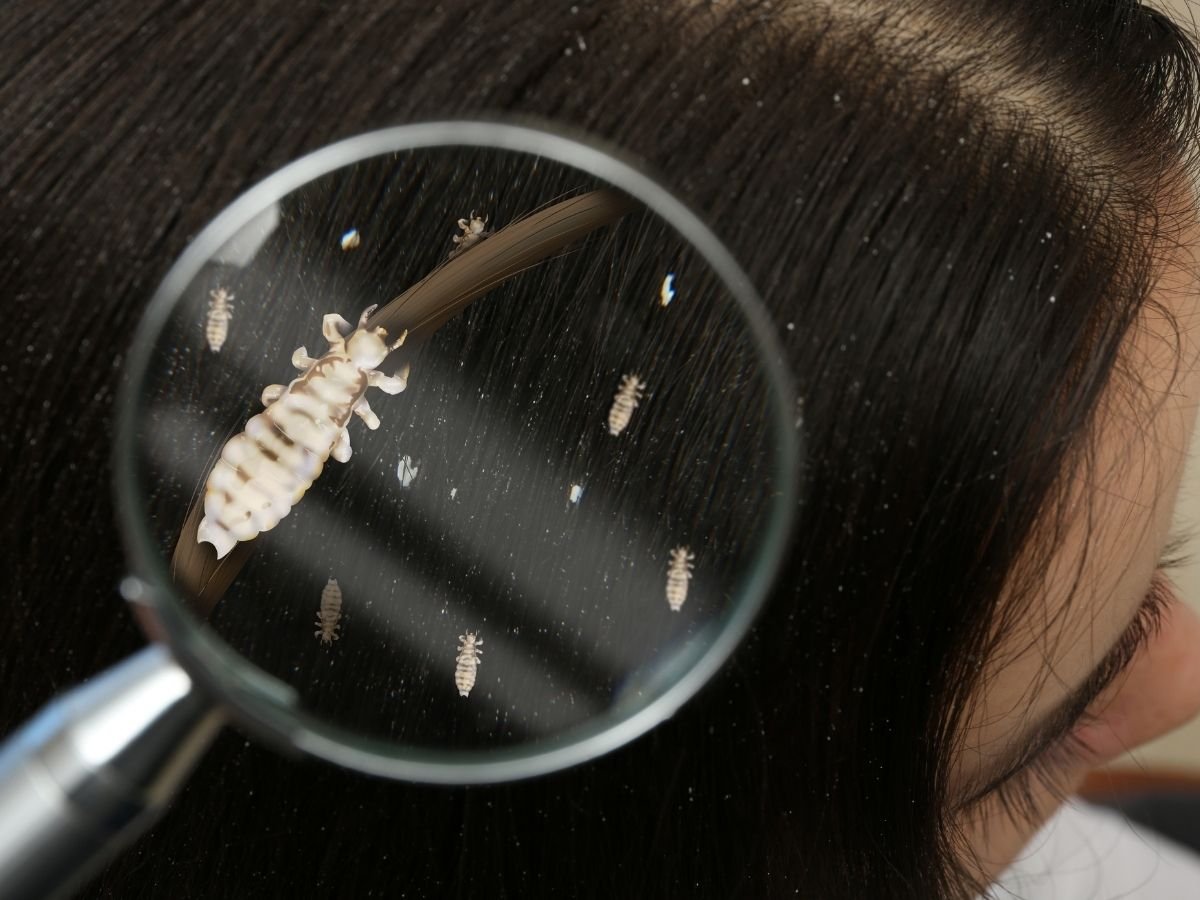 Why Upper East Side Families Prefer In-Home Lice Treatment