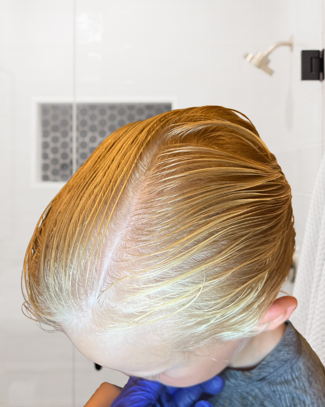 new jersey lice removal