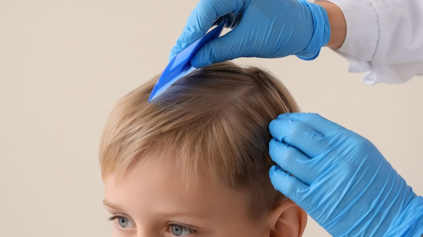 How Long Do Lice Eggs Survive Outside the Hair?
