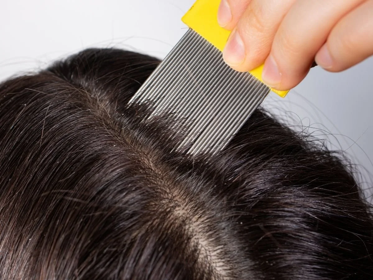 can kids get lice from swimming pools