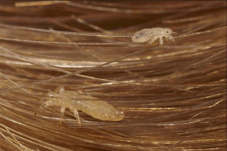 head lice