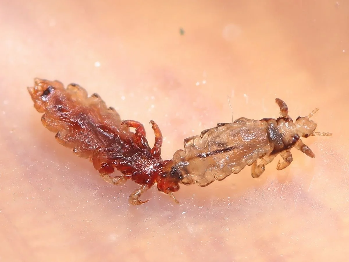 do natural lice treatments work
