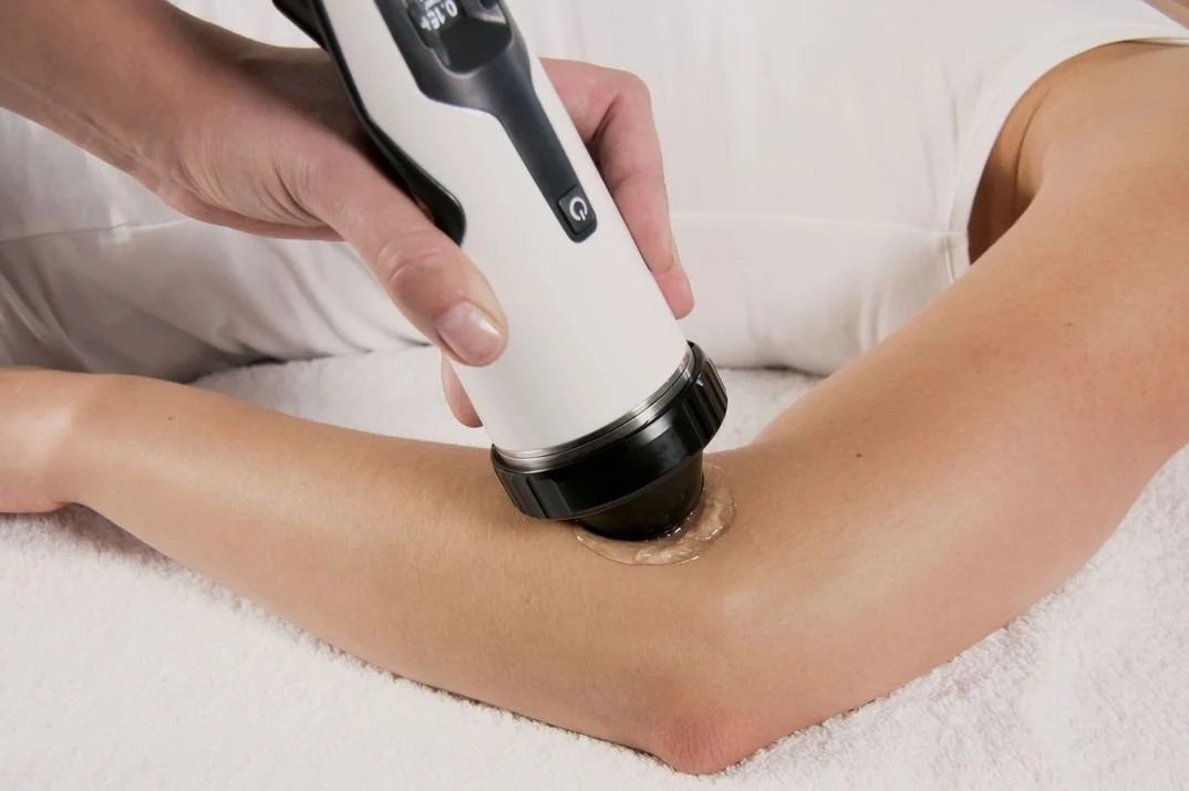 Focused shockwave handpiece is used for treatment on the outer elbow with person lying down