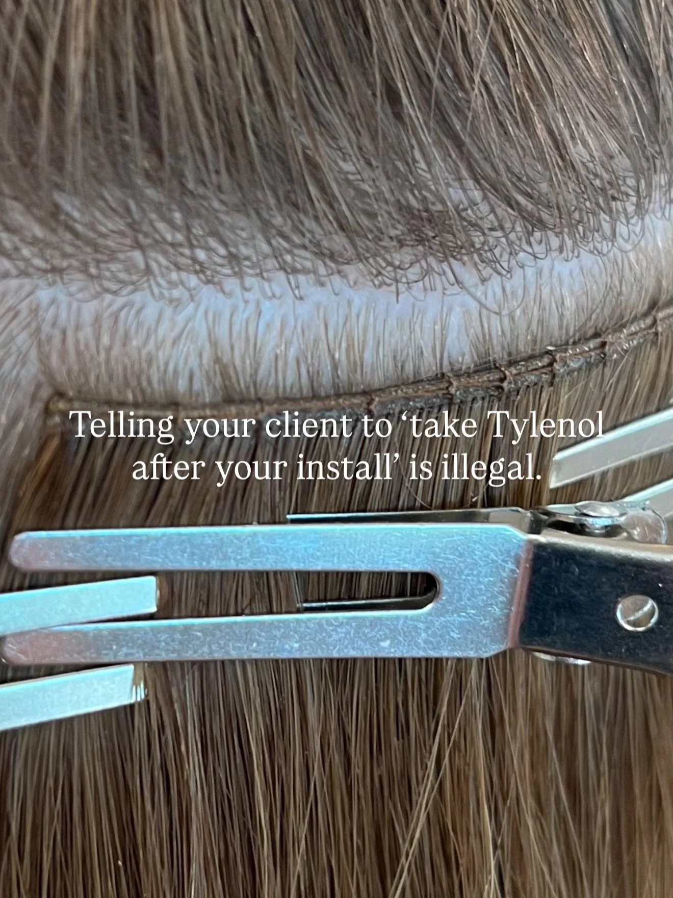 If you tell your client to &ldquo;take Tylenol&rdquo; after an install, you didn&rsquo;t just normalize pain&hellip;you broke the law.

You are not legally allowed to recommend medication.
&amp; honestly? You shouldn&rsquo;t have to.

Extensions shou