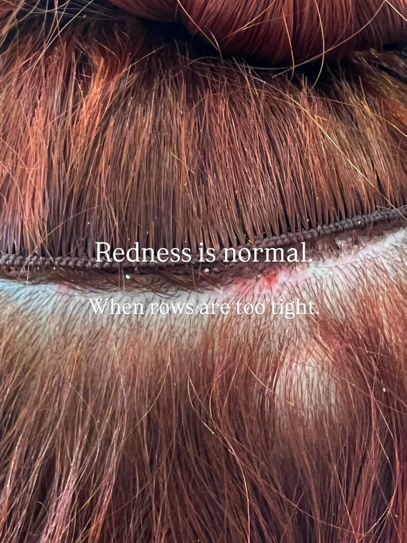 If you can&rsquo;t see it you can&rsquo;t fix it 💁&zwj;♀️

⚪ TENSION OVERLOAD

That stark white?
That&rsquo;s blood displacement from pull.

Tension = pull.

It means the row is pulling hard enough that the skin can&rsquo;t perfuse blood into the ar