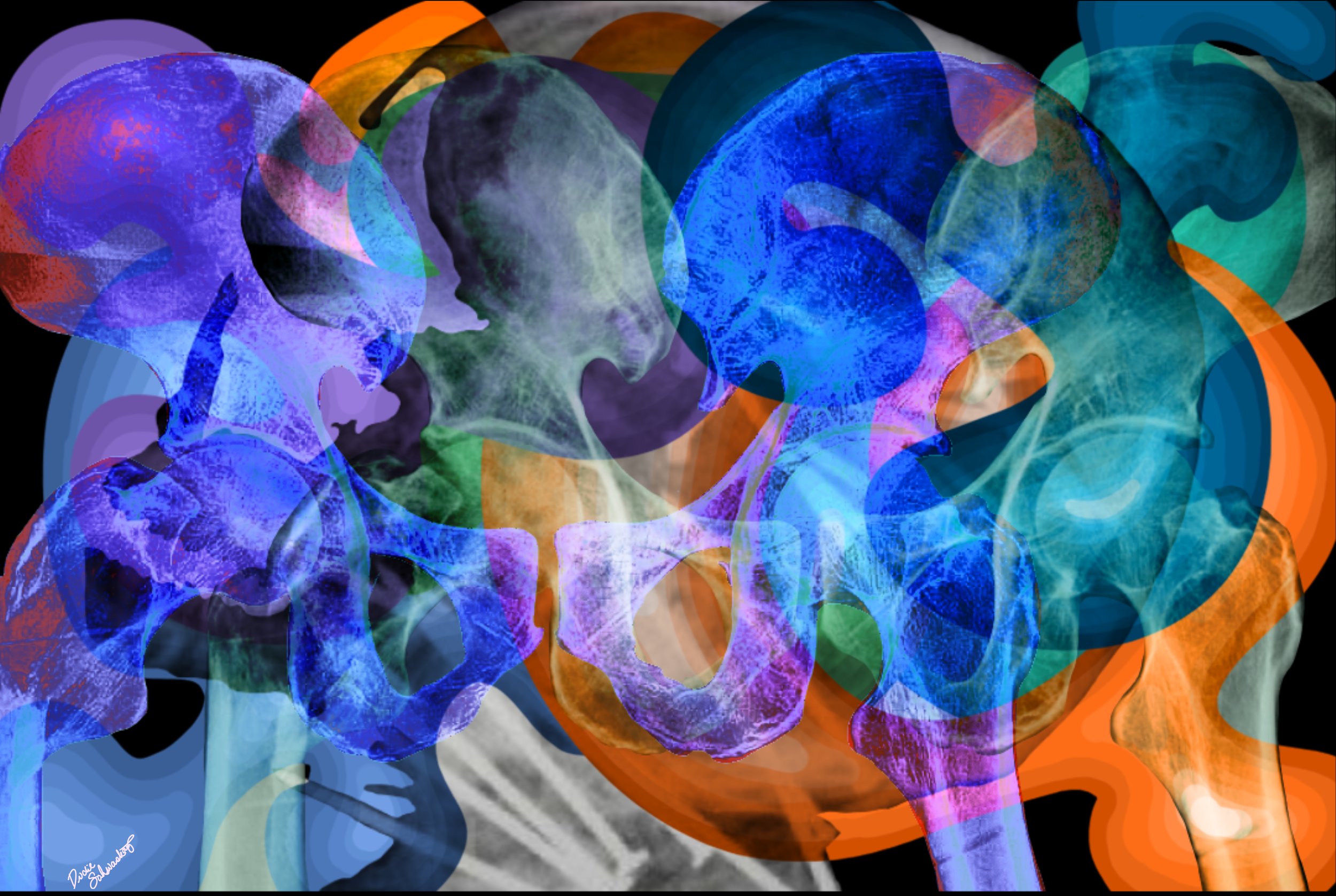 Hips_and_Xray.jpg