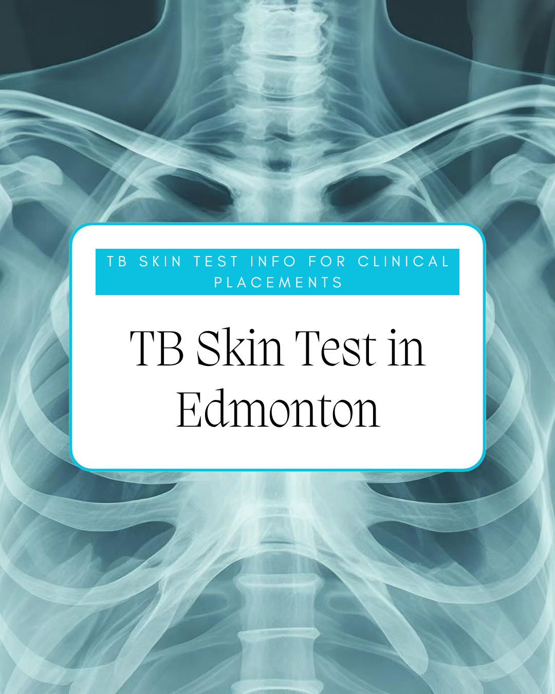 TB Skin Test Edmonton: What Students Need to Know Before Their Clinical Placements