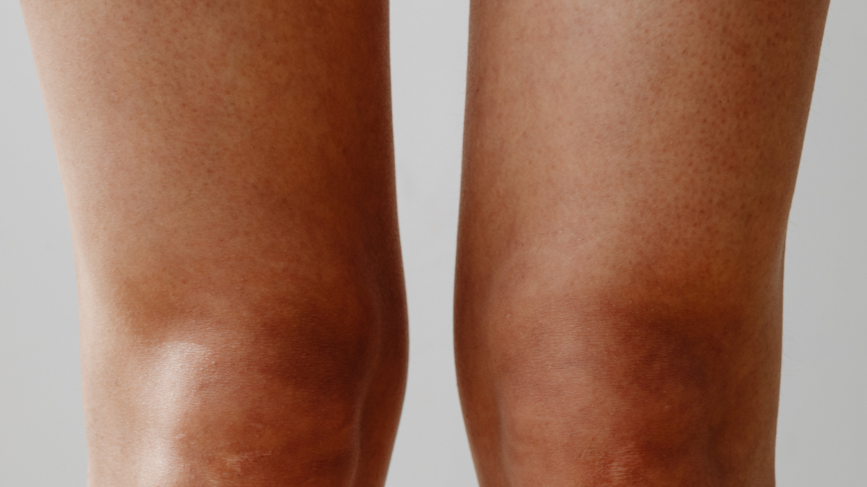 How to Prevent Bumps After Waxing: Complete Post-Wax Skin Care Guide