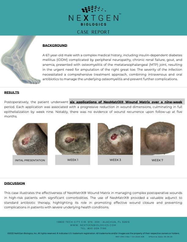 MKT-018-3 Rev 1 Case Report - MTP Amputation_Controlled.png